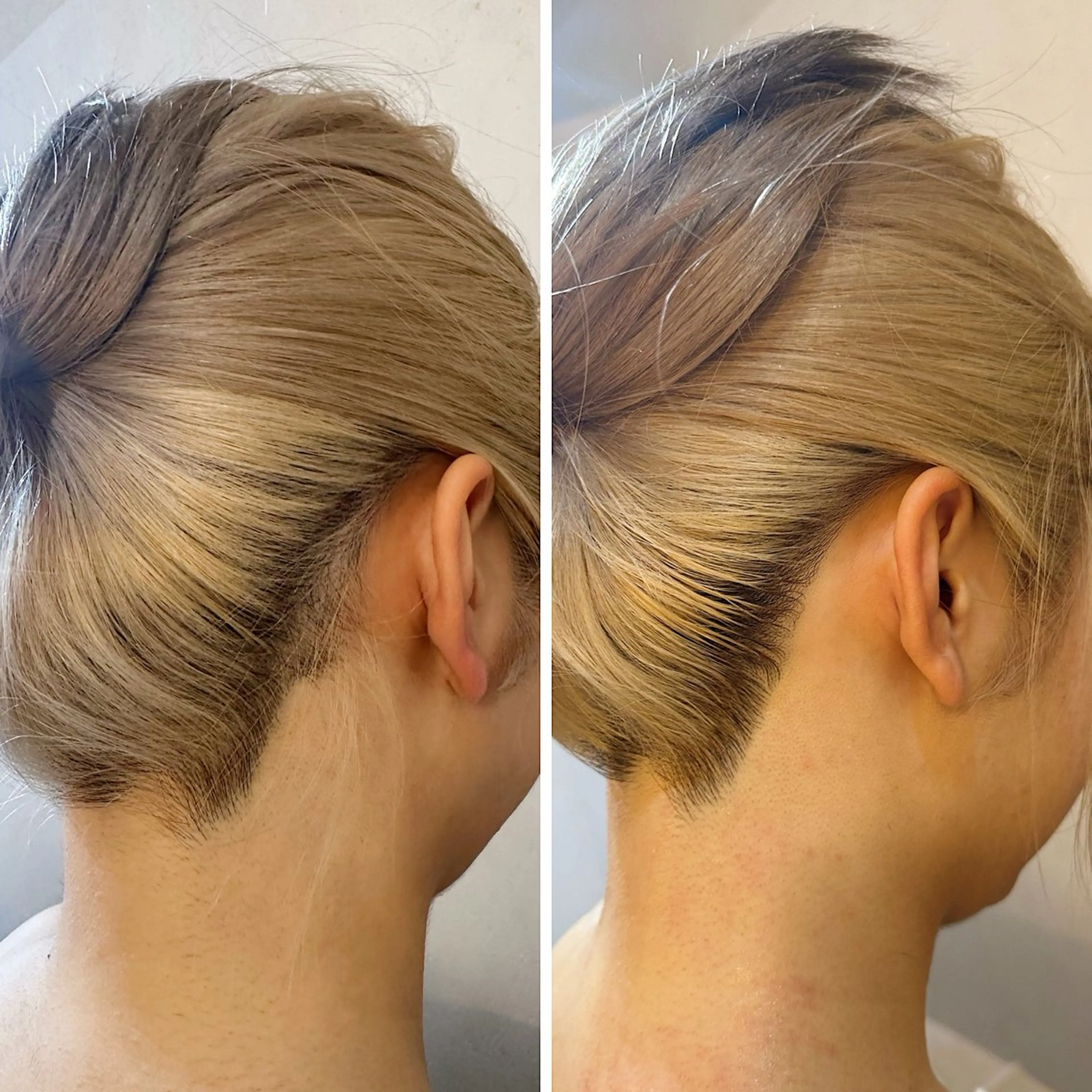 脱毛 うなじ脱毛/美肌脱毛 LABELのエステ・リラクイメージ