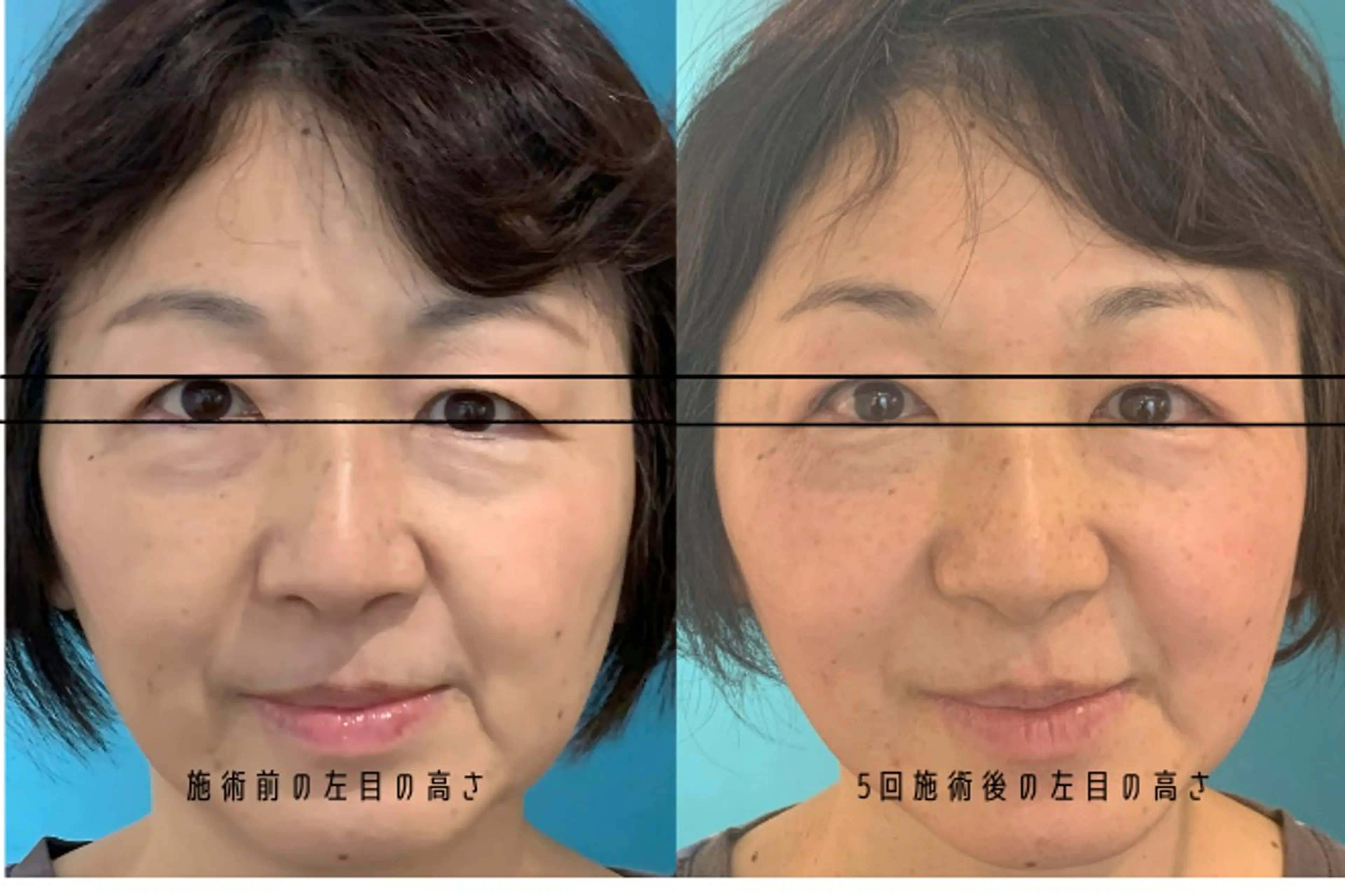 撮影モデル Nexfit for Beauty小顔矯正のエステ・リラクイメージ