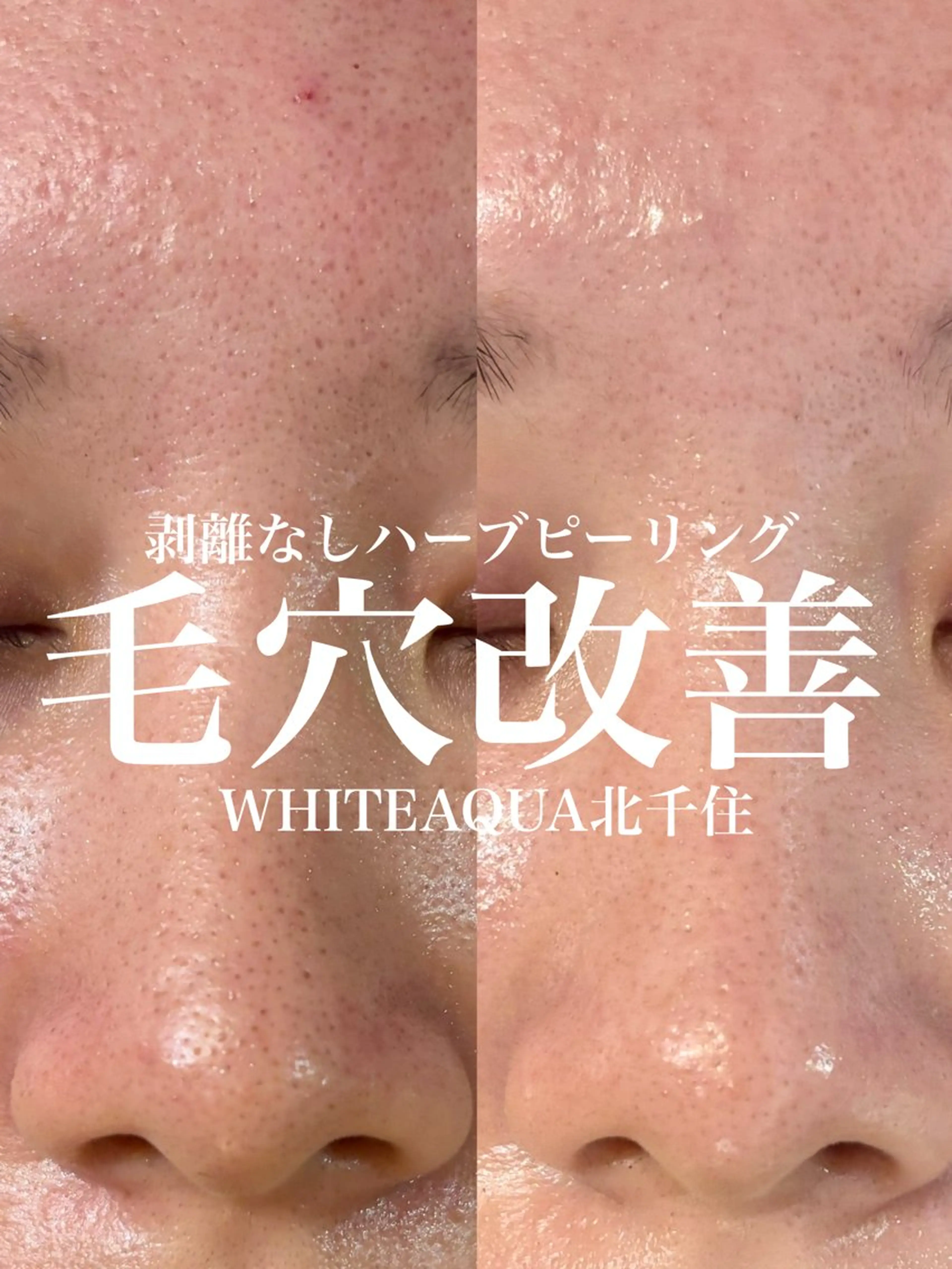 エステ WHITE AQUA 北千住店のエステ・リラクイメージ