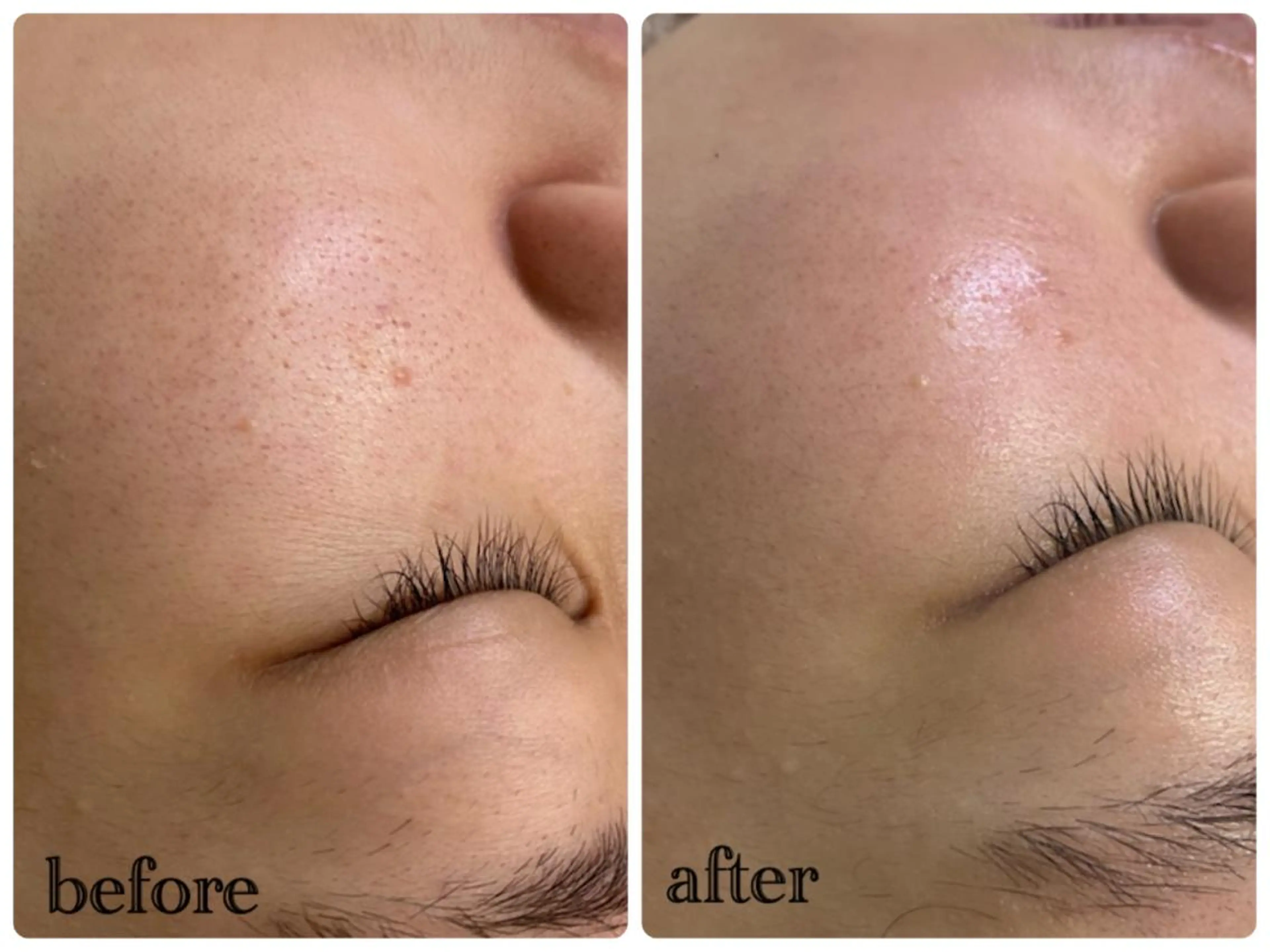 デ・アイム新潟北所属・サイトウ .のエステ・リラクイメージ