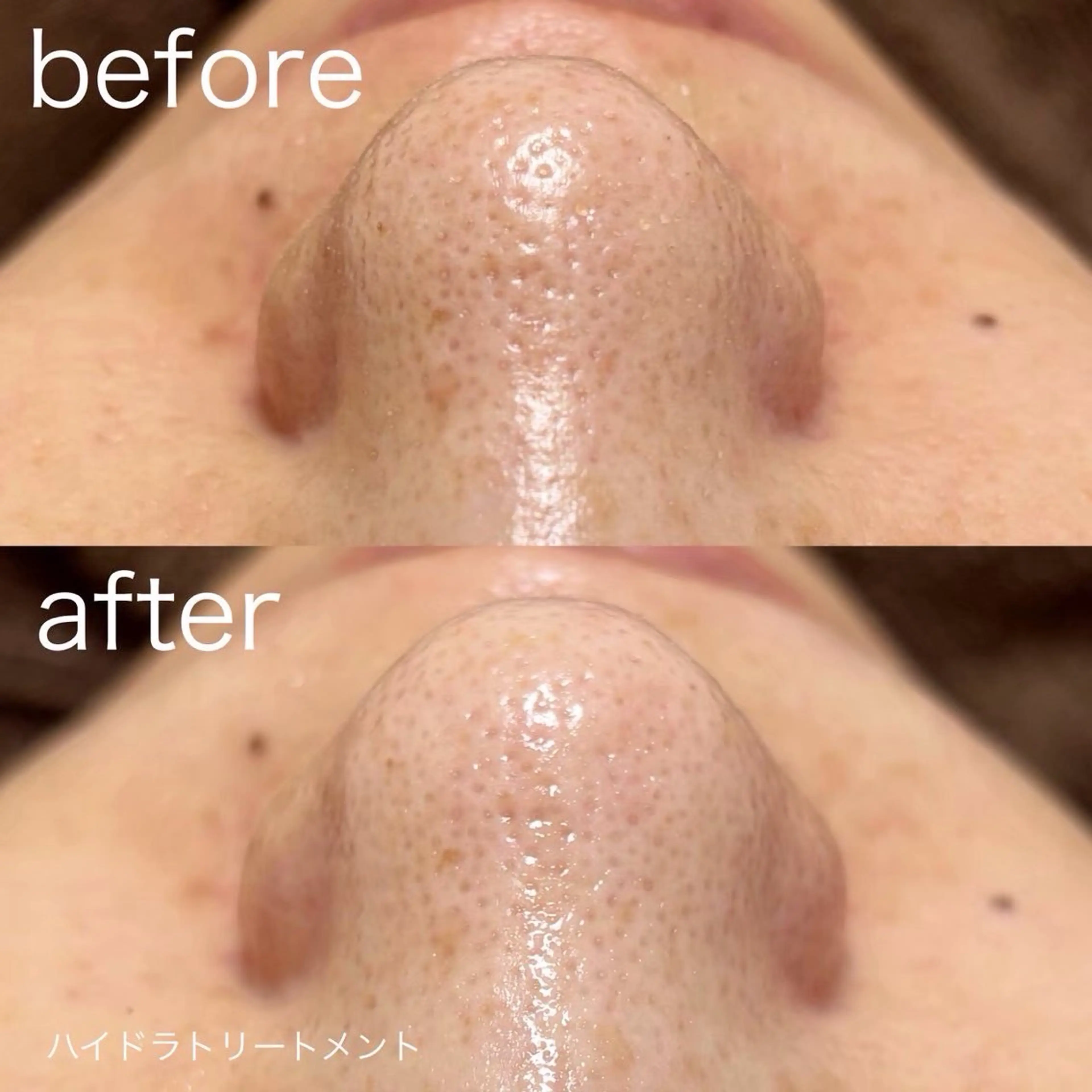 脱毛 lulula ricoのエステ・リラクイメージ