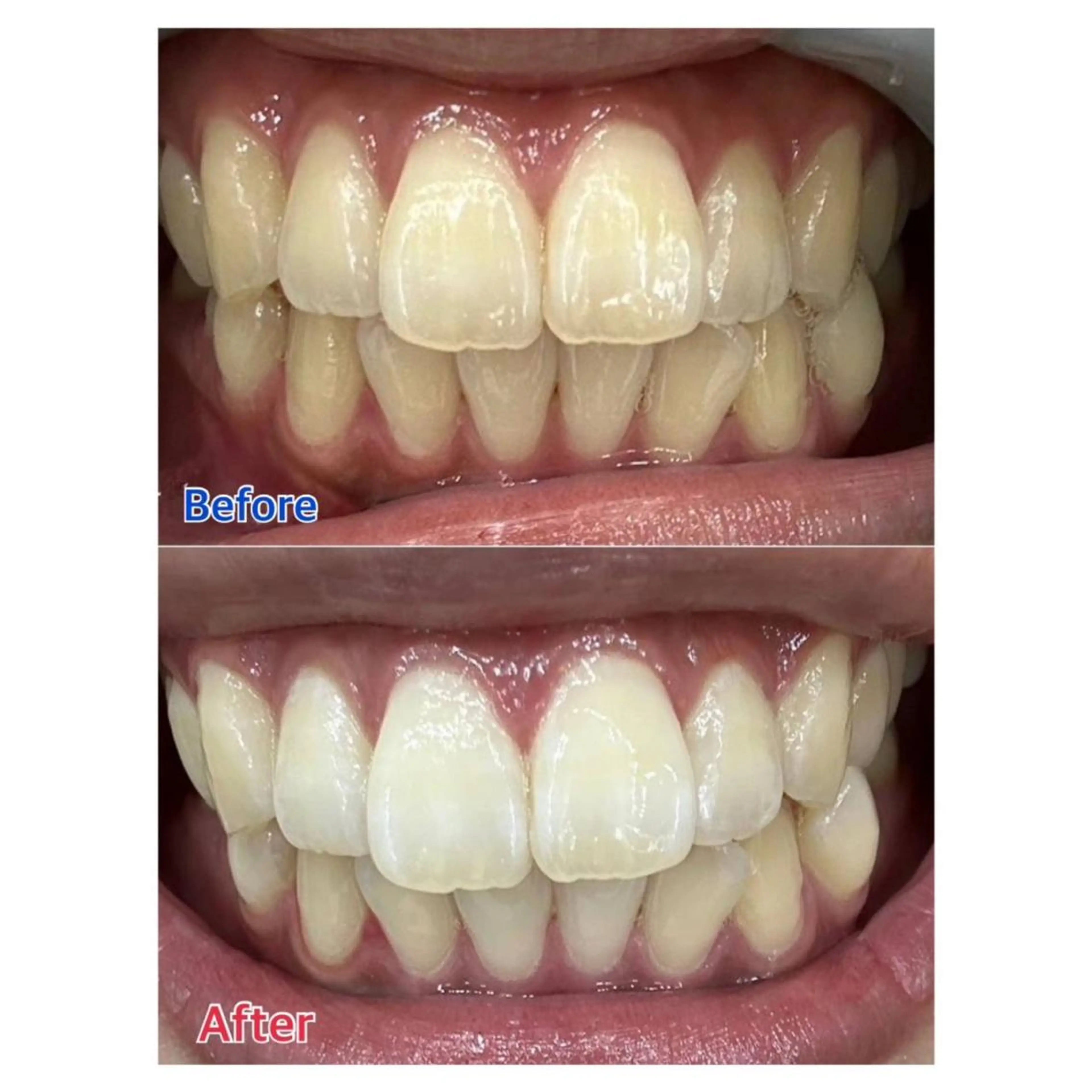 MBEAUTYSALON 千葉店・京成大久保所属・Melty 輝のその他イメージ