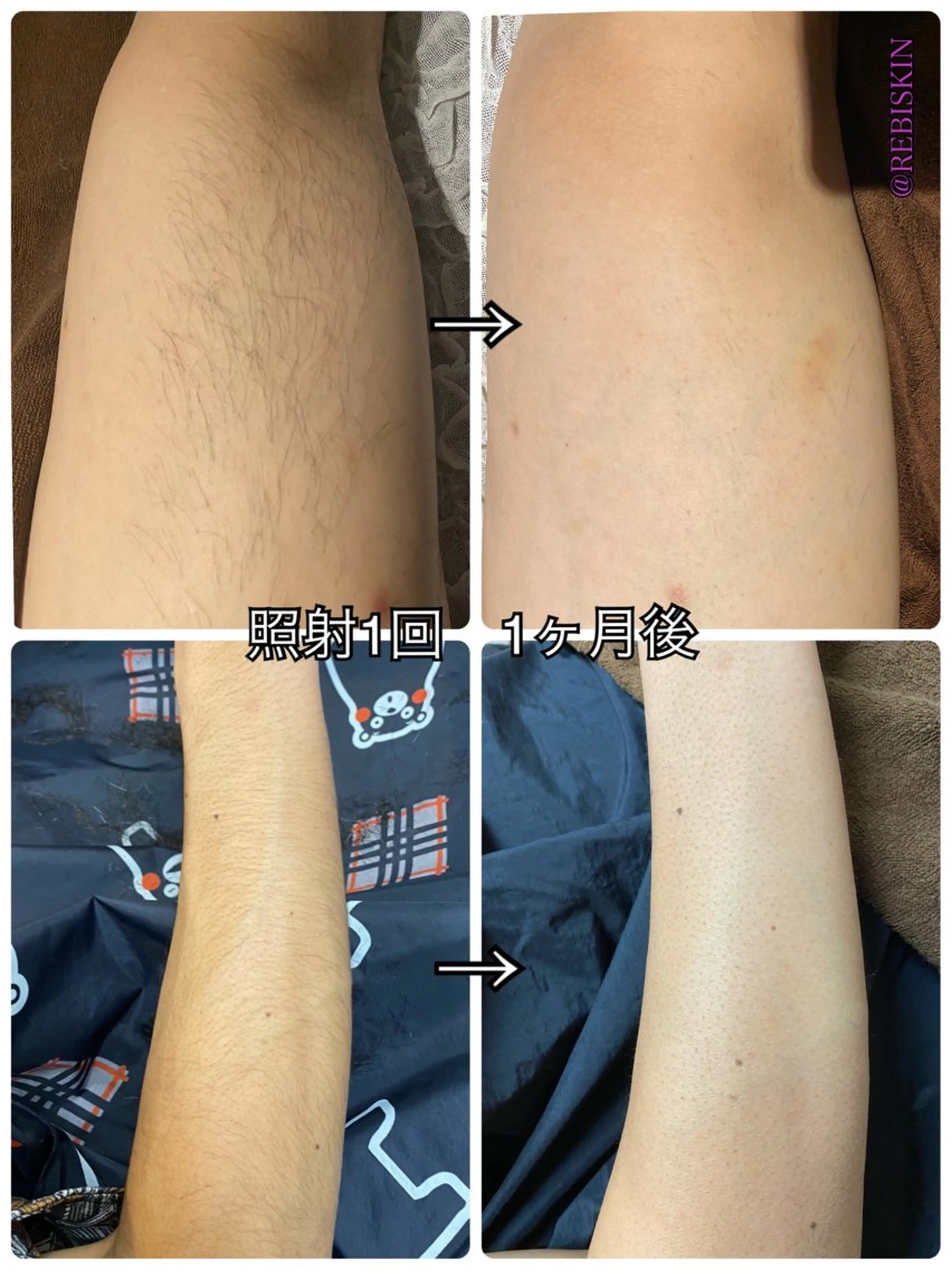 【痩身・脱毛サロン】 REBISKIN🌱のエステ・リラクイメージ