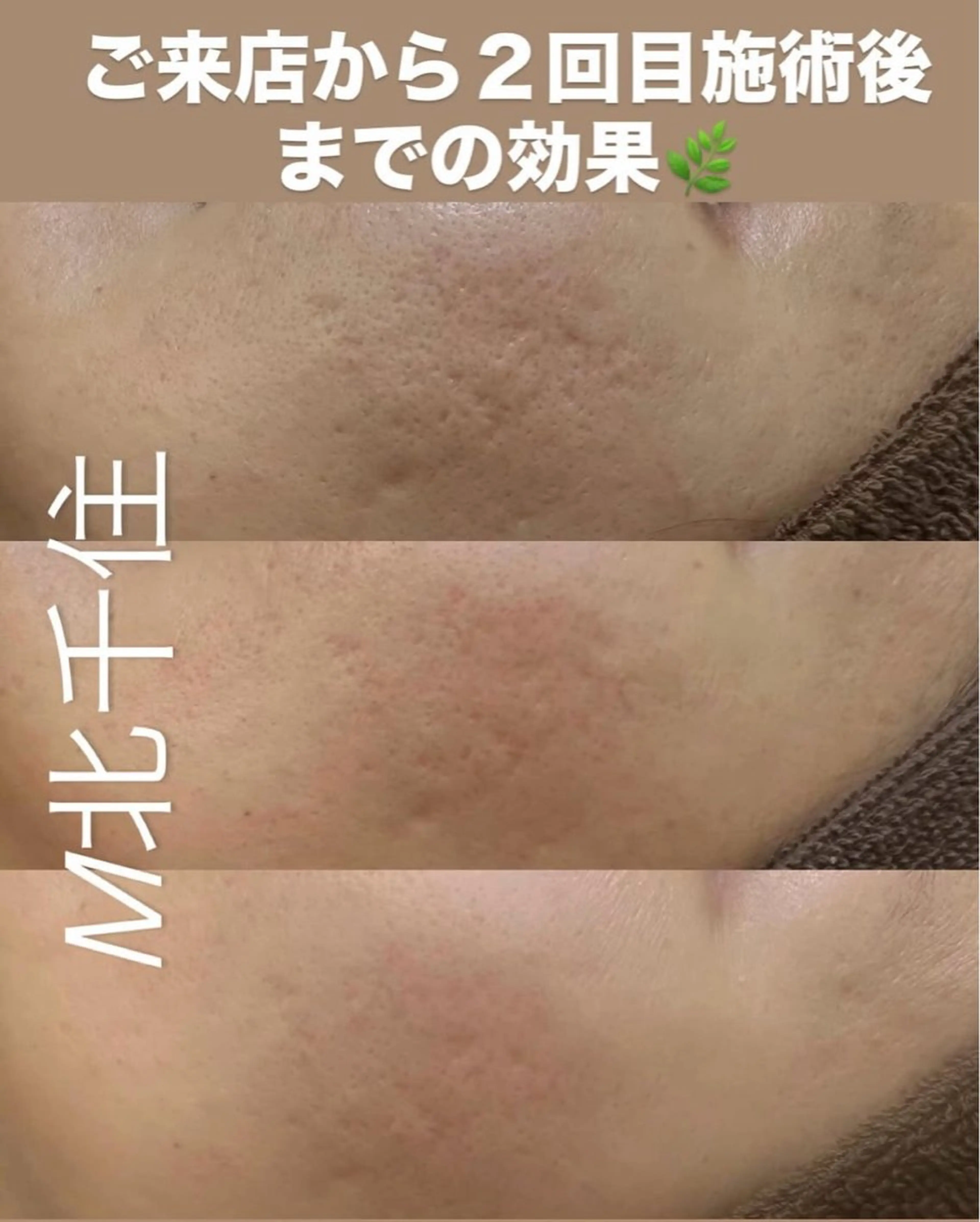 メニューにお悩みの方🌿¥5500​〜​¥15000 メンズ歓迎！！の写真