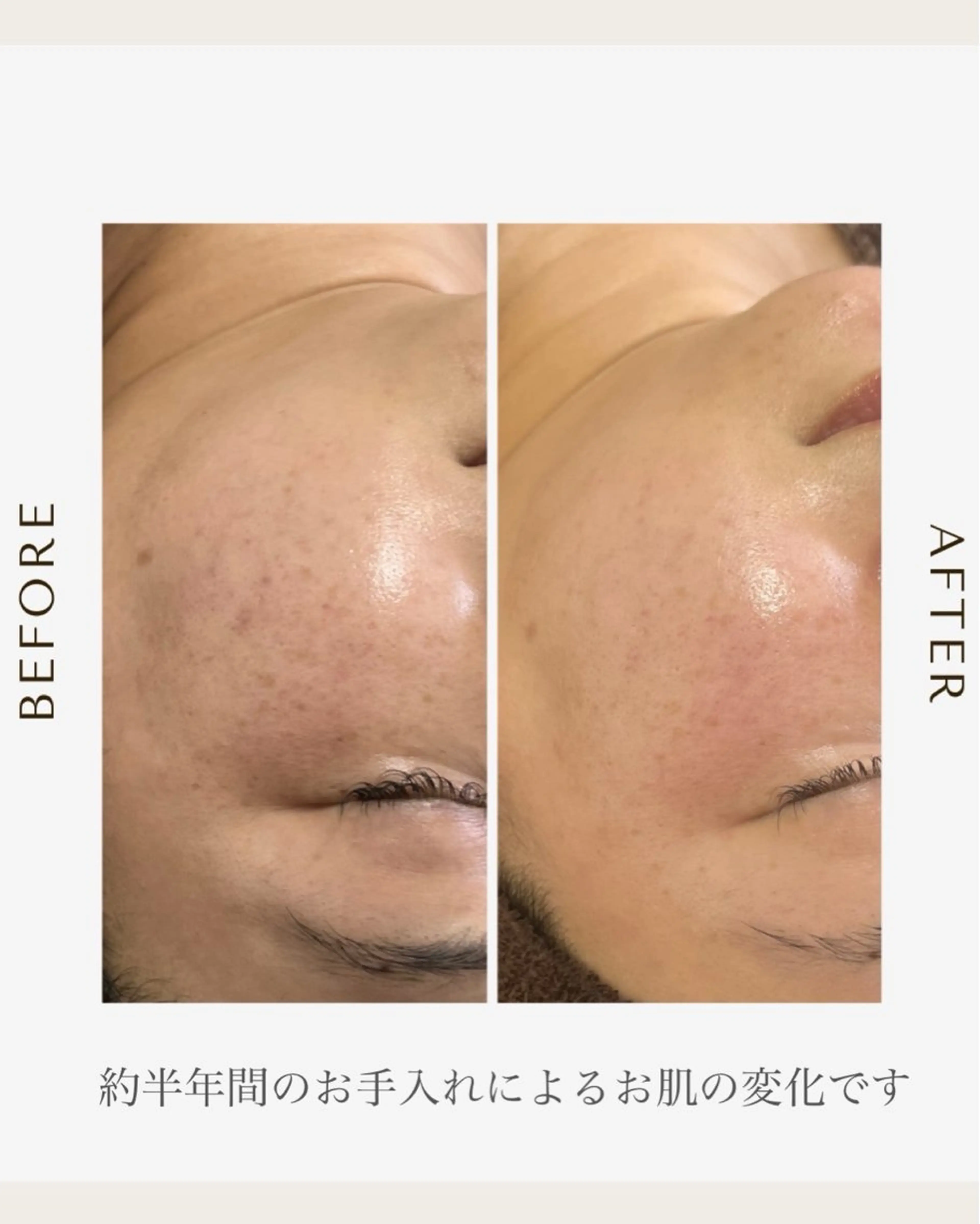 エステ 1st｜フェイシャル エステ専門店のエステ・リラクイメージ