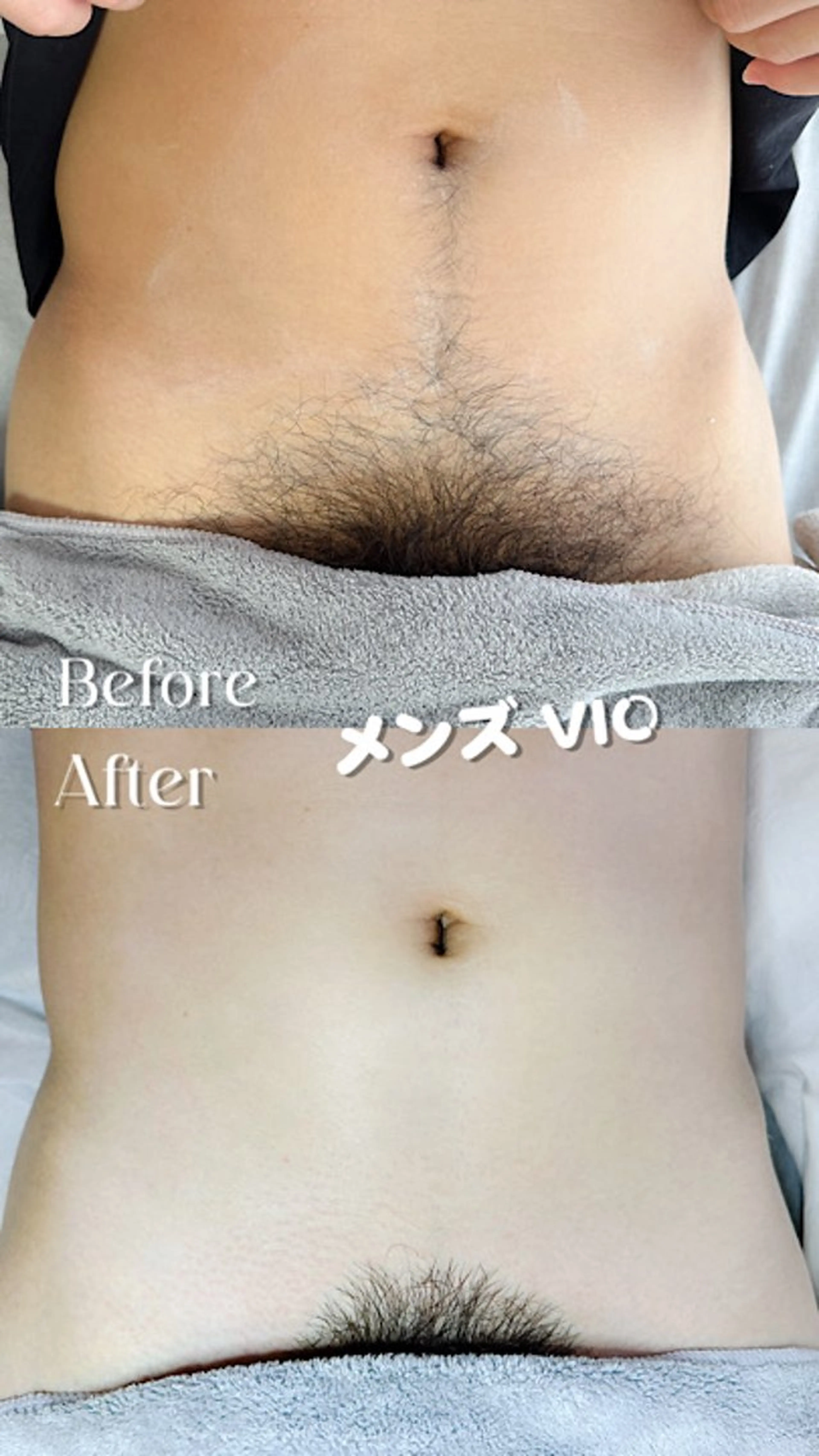 Hit. シュガーリング豊橋のエステ・リラクイメージ