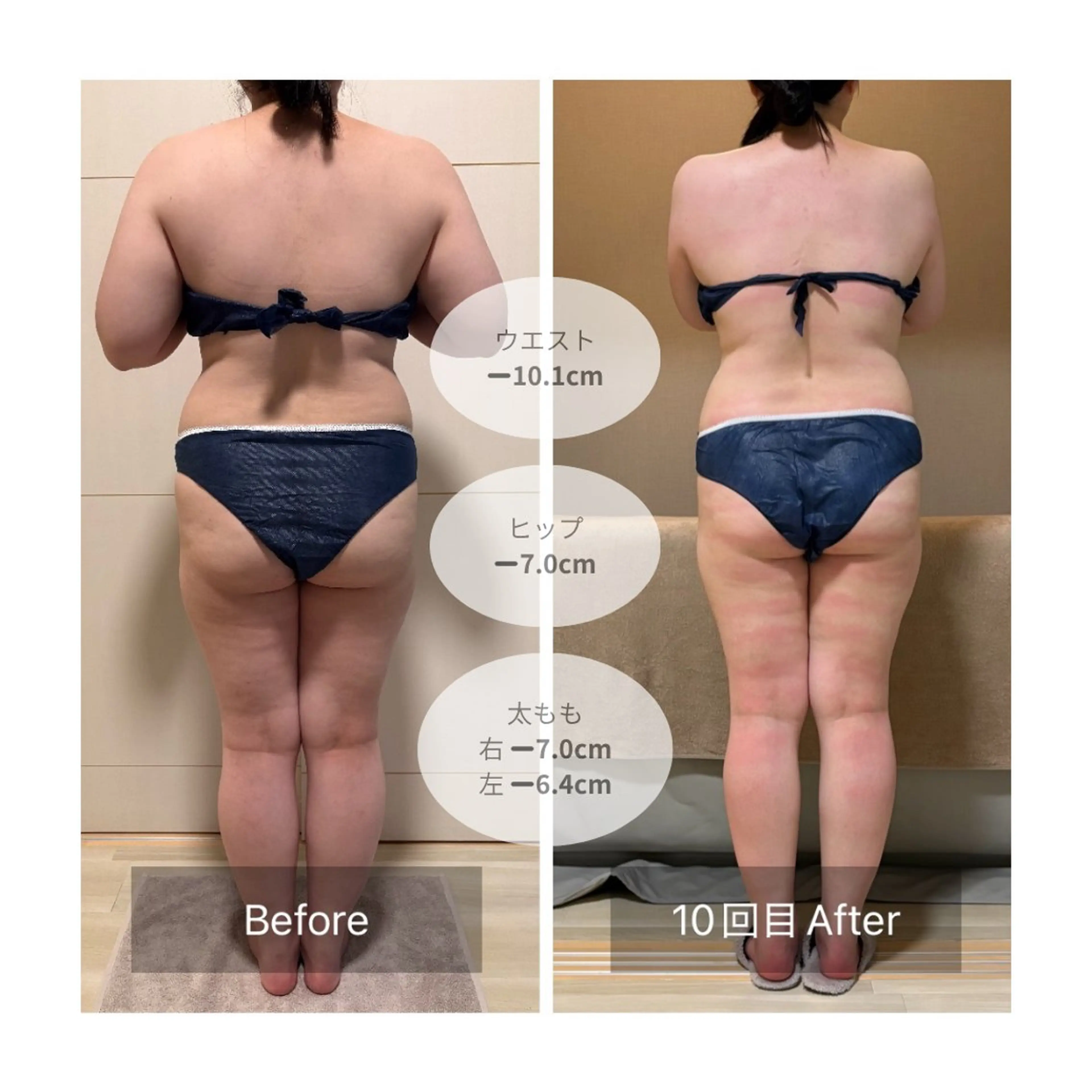 【2025年ミニモ期間限定プレミアム🎁】デコルテ・首肩・ヘッド極上パワーレメディ60分✨深層部へ届く極上トリートメントの写真