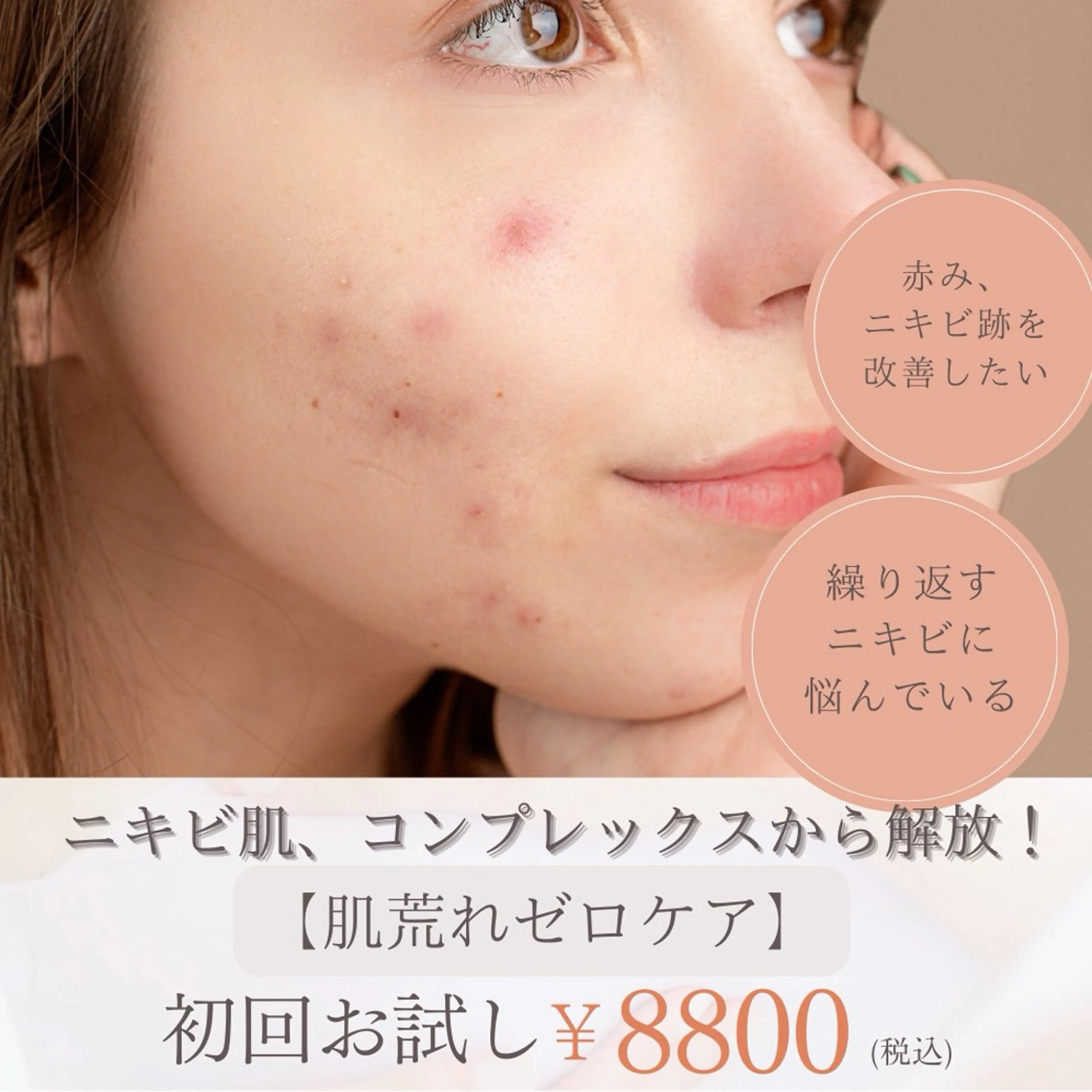 【ブツブツ・肌荒れから解放】１回目から効果を実感！“肌荒れゼロケア”の写真