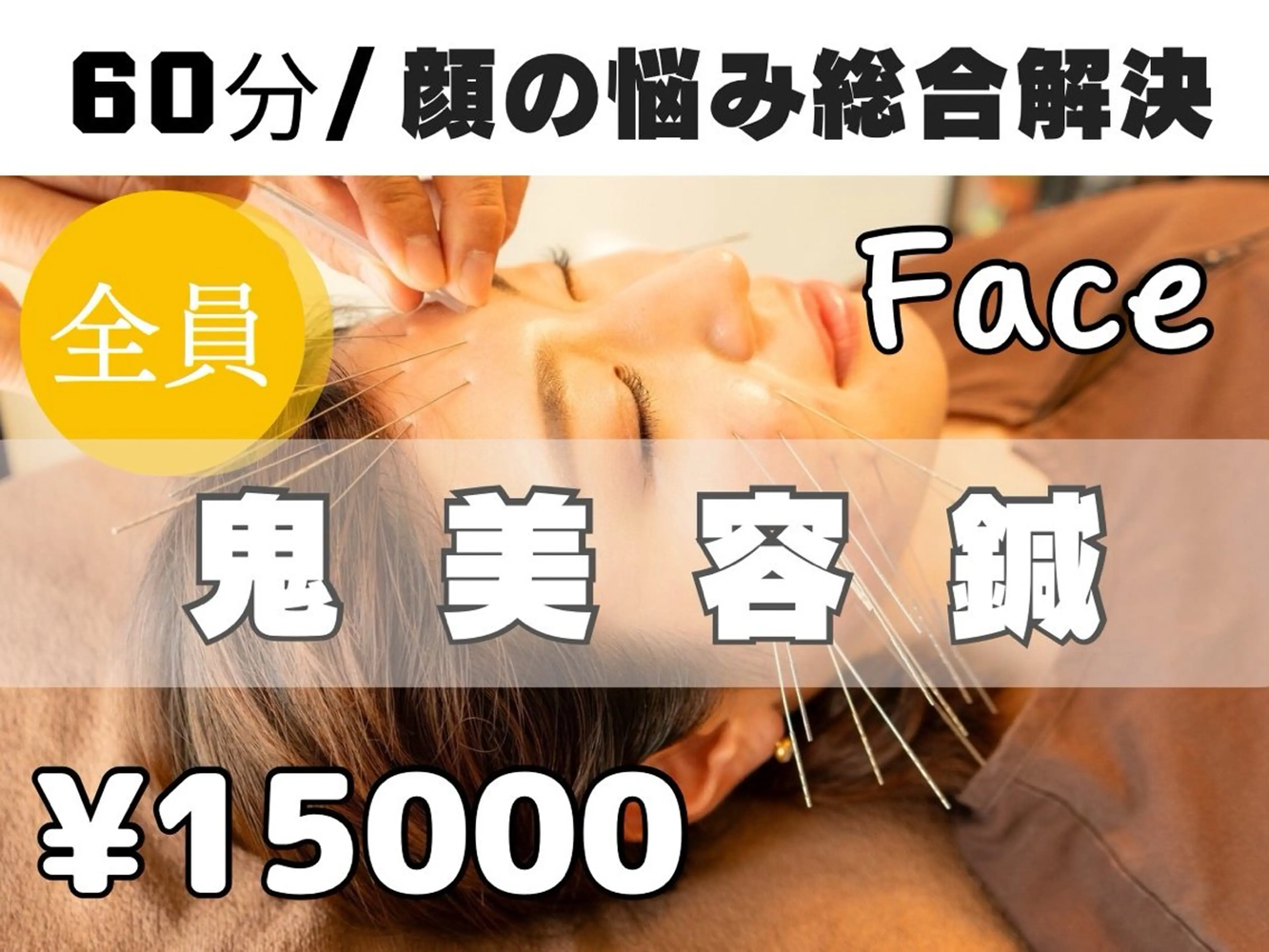 【シワ・たるみ改善・驚異の小顔効果】鬼美容鍼60分15,000円の写真