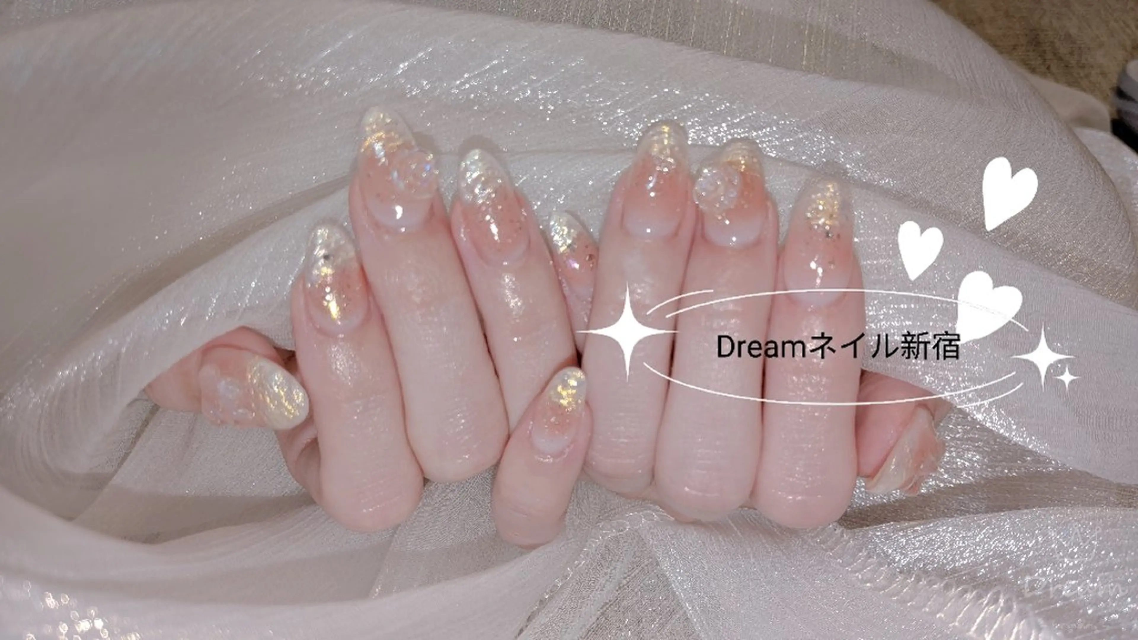 ネイル ハンドネイル ネイリストゆか💅 長さだし、深爪矯正のネイルデザイン