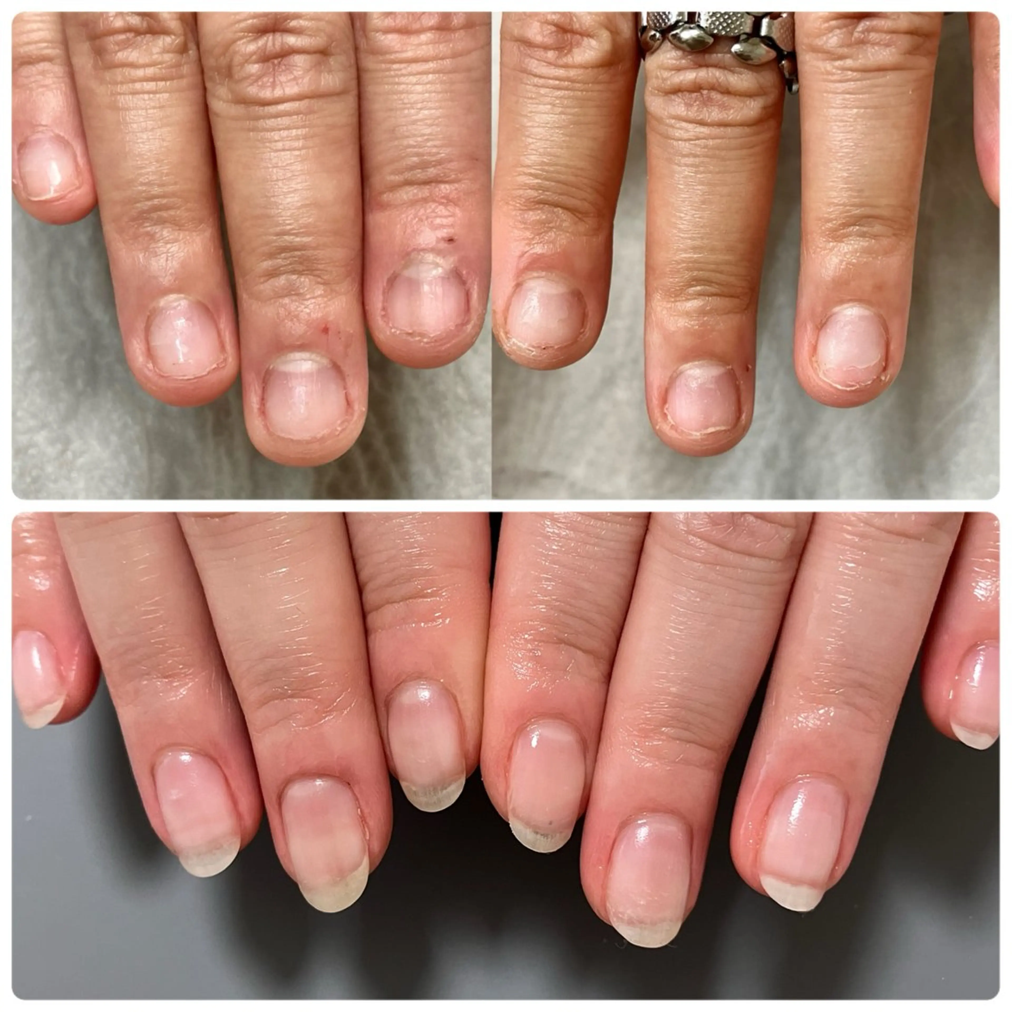 自爪育成コースの写真