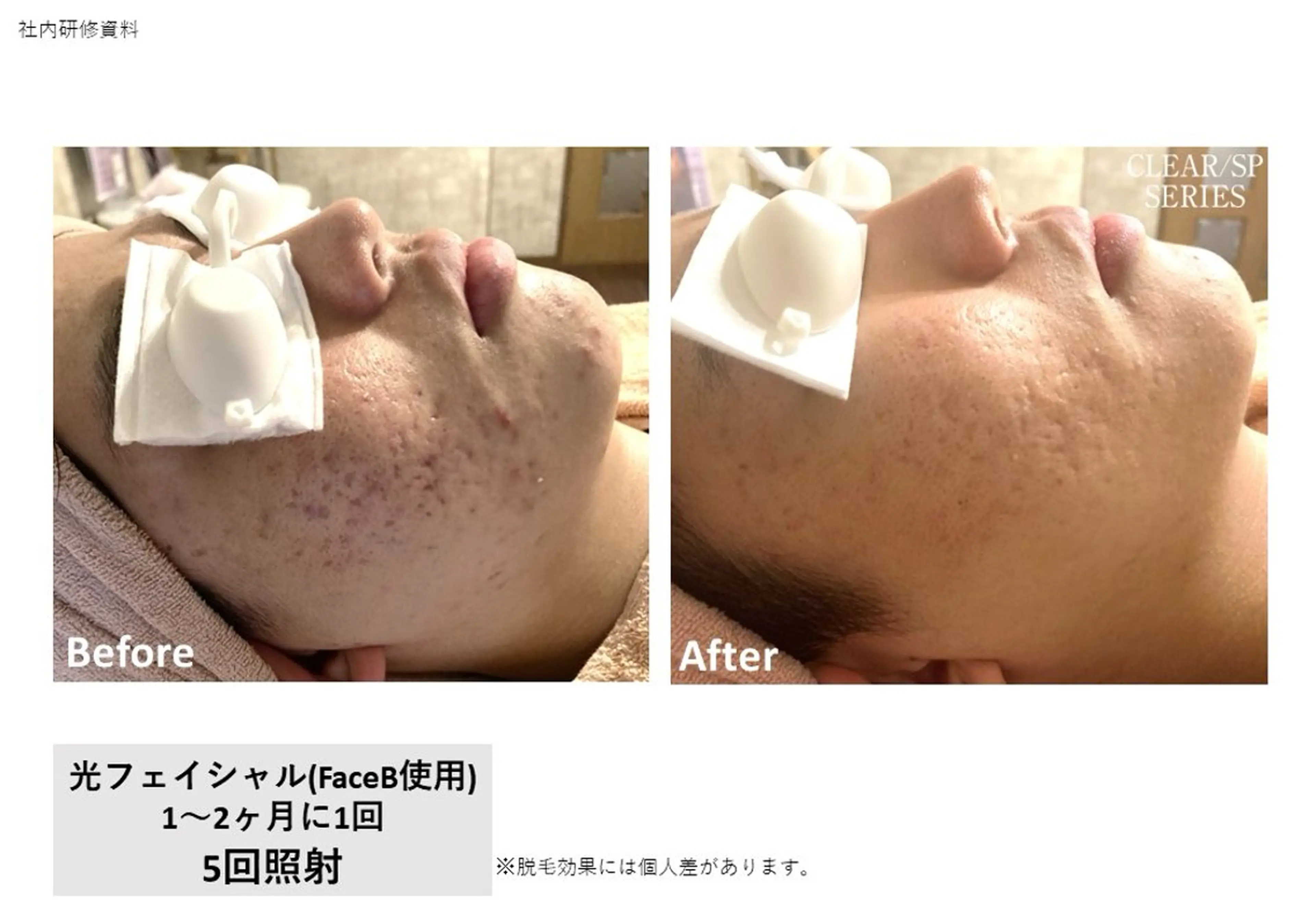 VIERU YURIのネイルデザイン