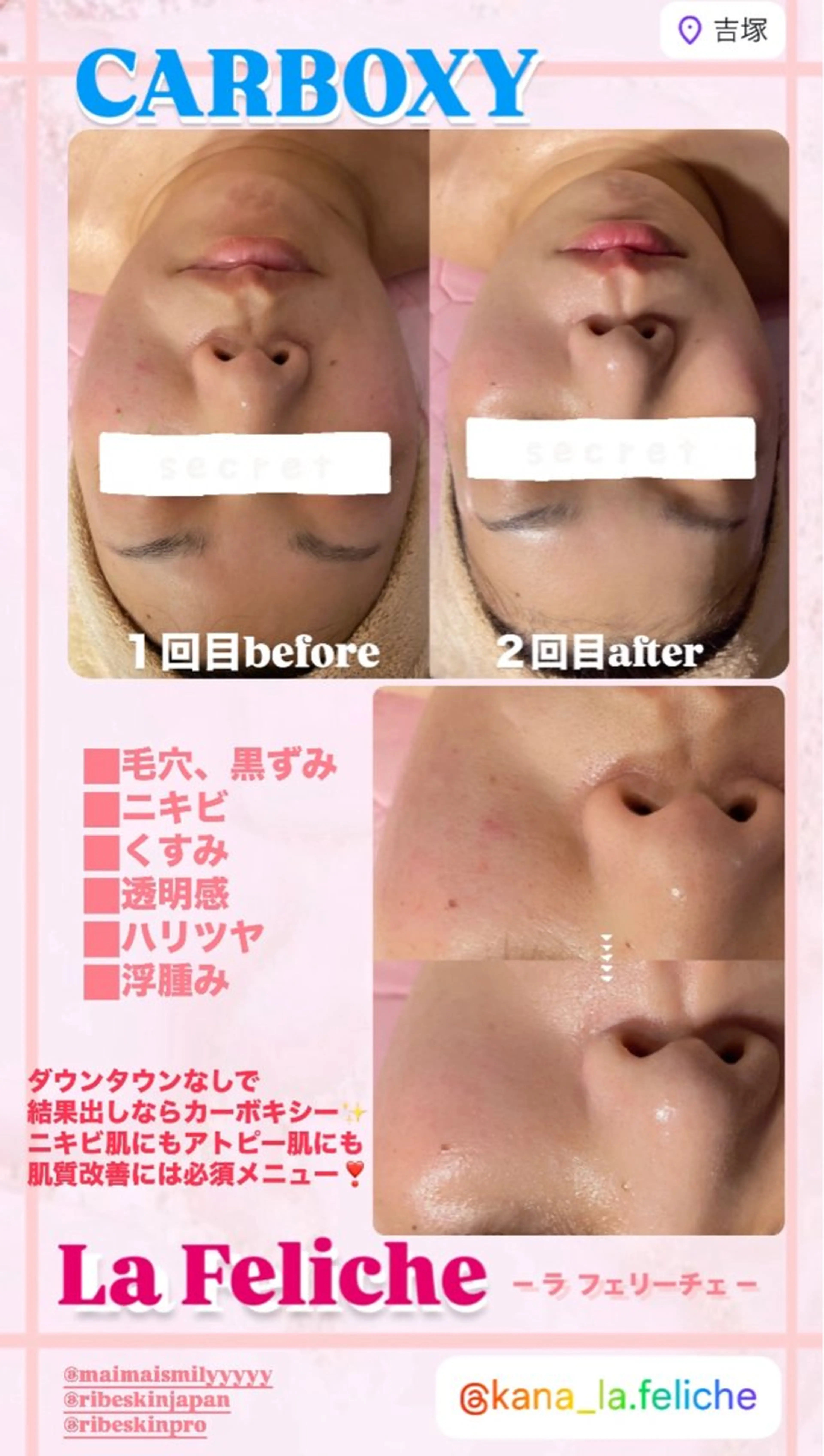 エステ La Feliche 佳奈のエステ・リラクイメージ