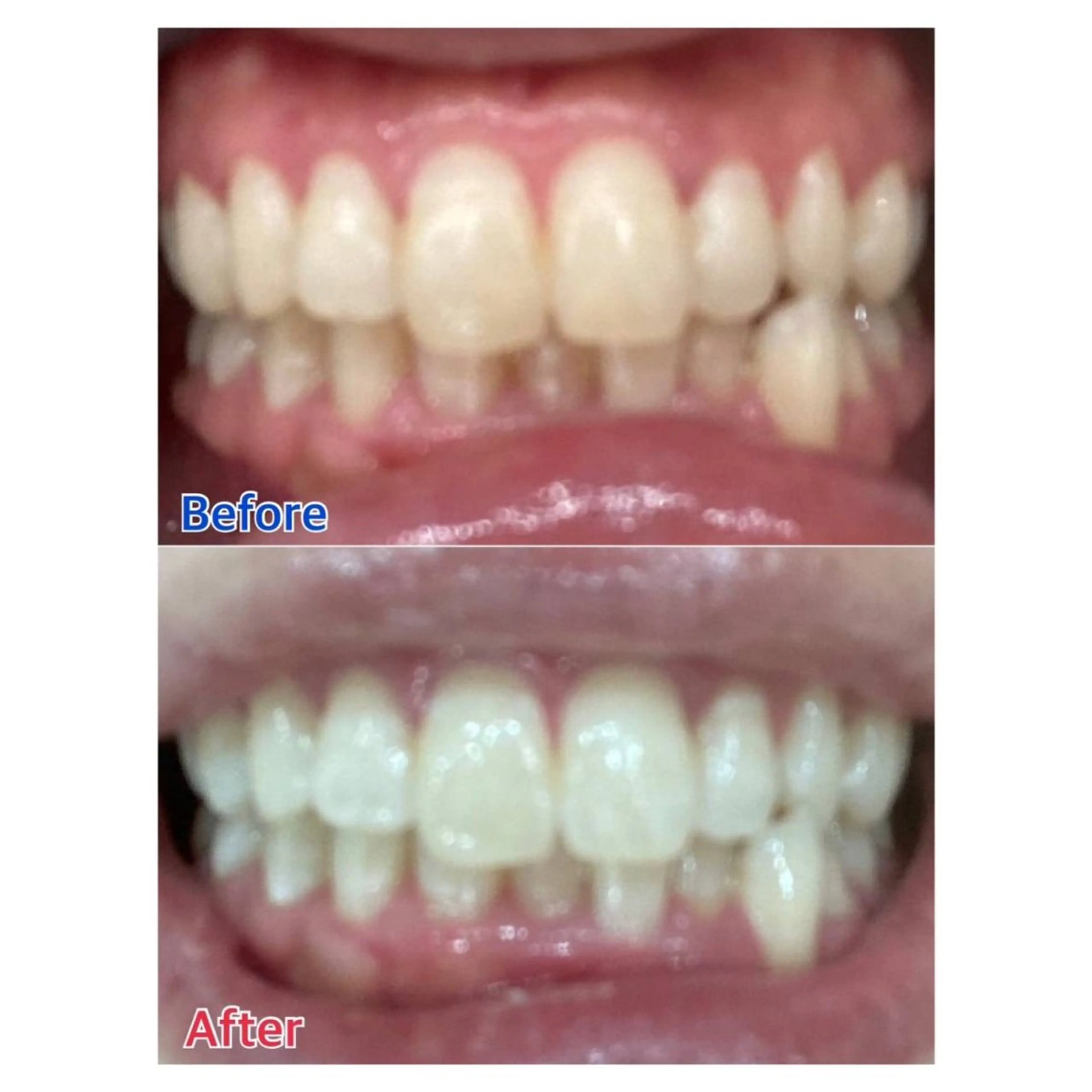 MBEAUTYSALON 千葉店・京成大久保所属・Melty 輝のその他イメージ