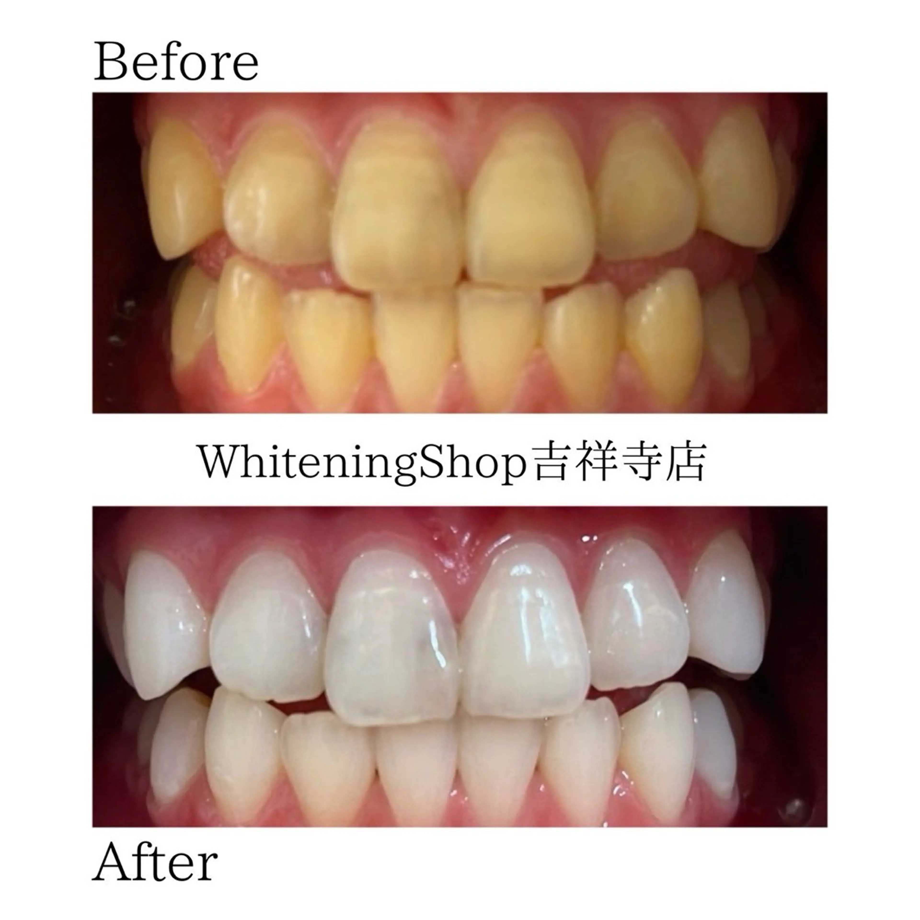 エステ リラク ホワイトニング ショップ吉祥寺店のエステ・リラクイメージ