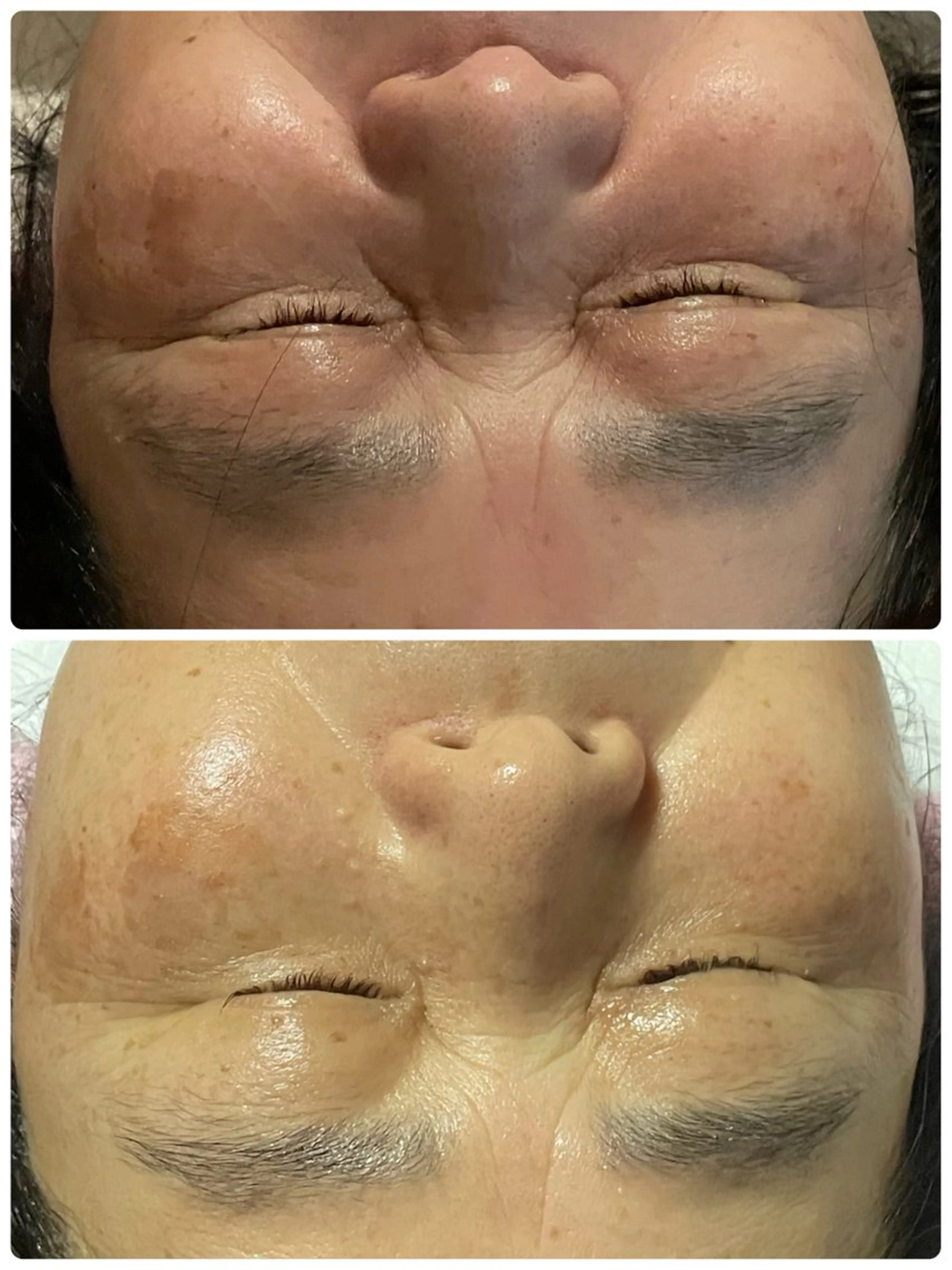 Salon Rion所属・Rion 野々村のエステ・リラクイメージ