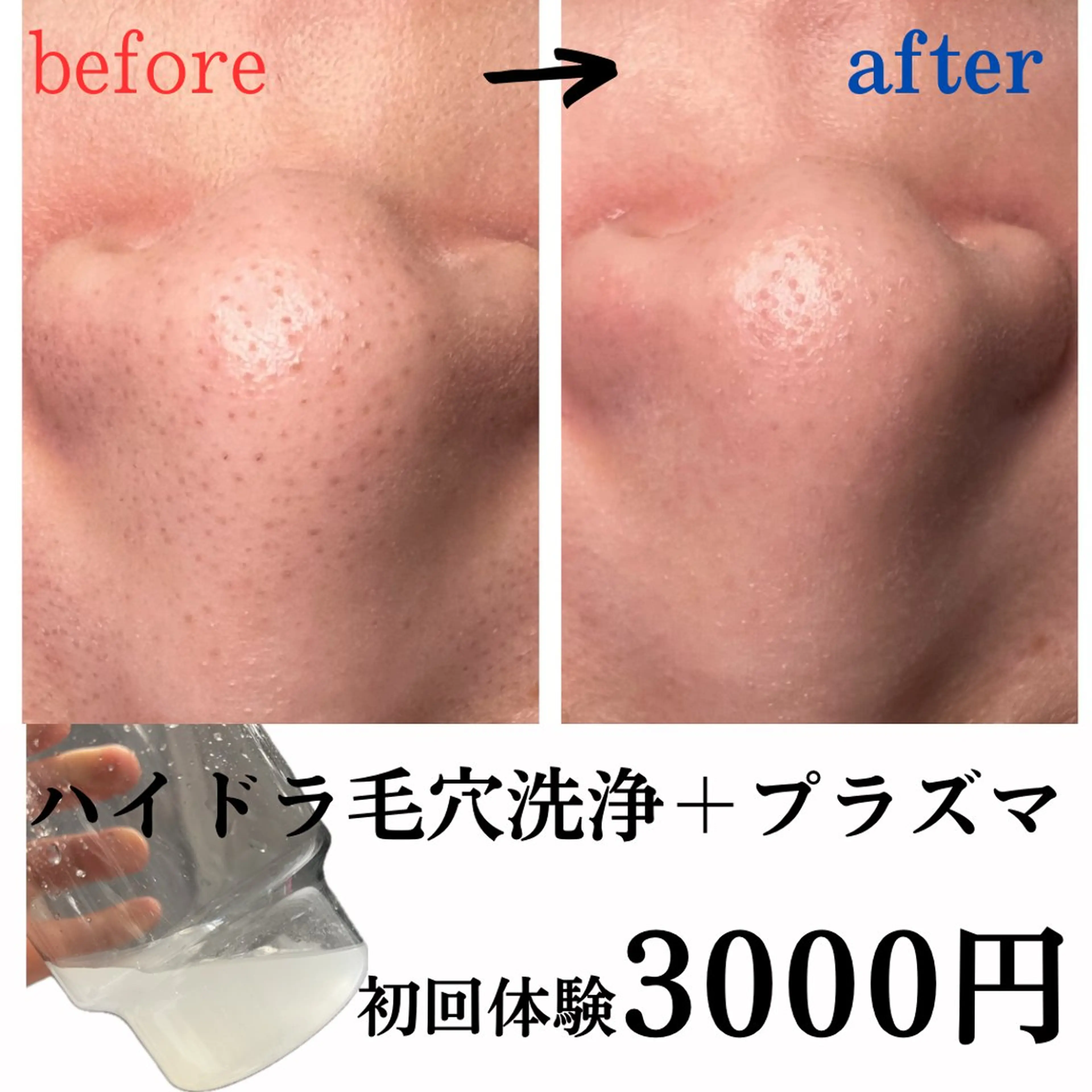 Babel  Total beauty所属・Babel kumiのエステ・リラクイメージ