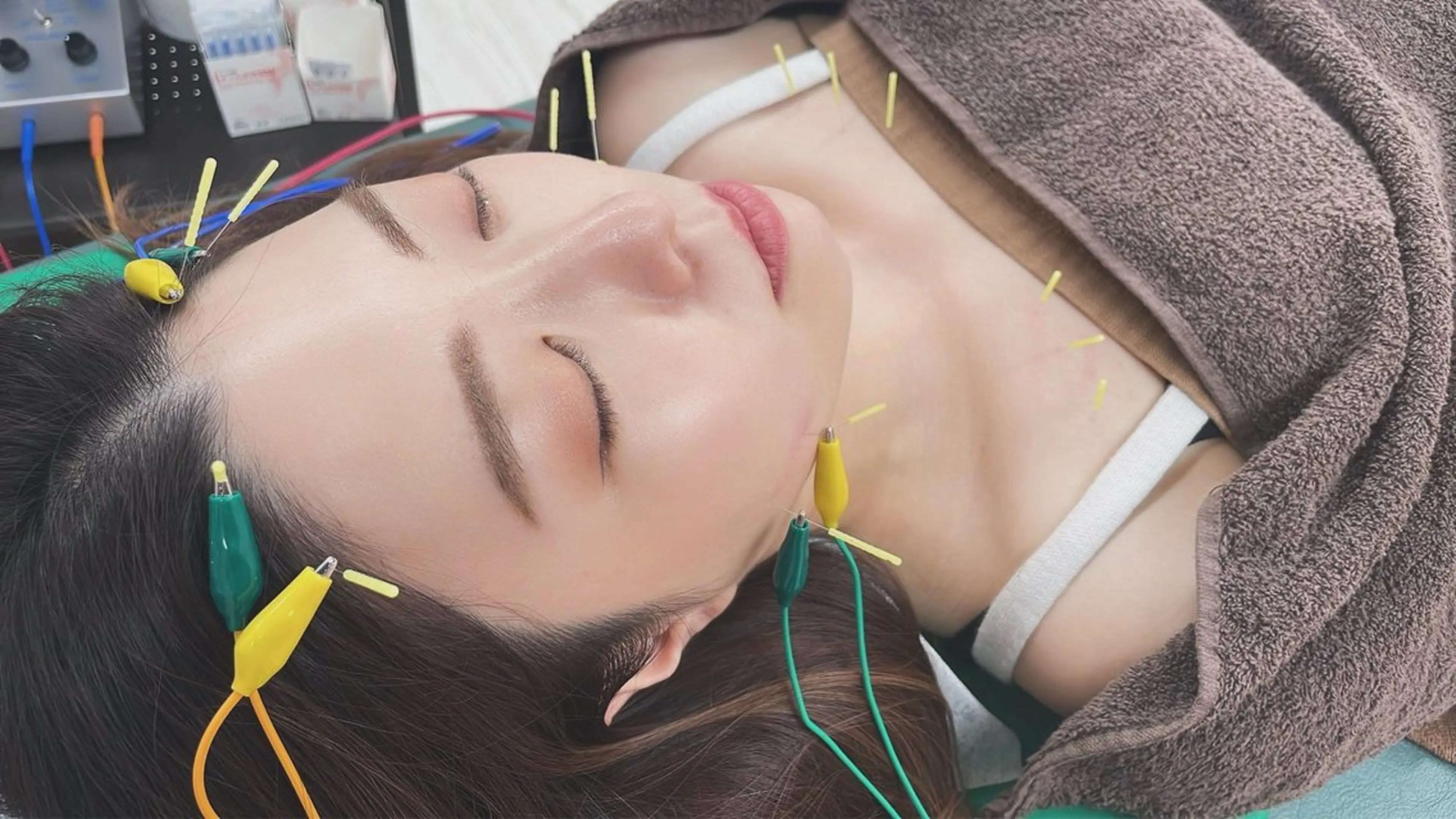 🌸【モデル募集】初級美容鍼体験コース🌸の写真