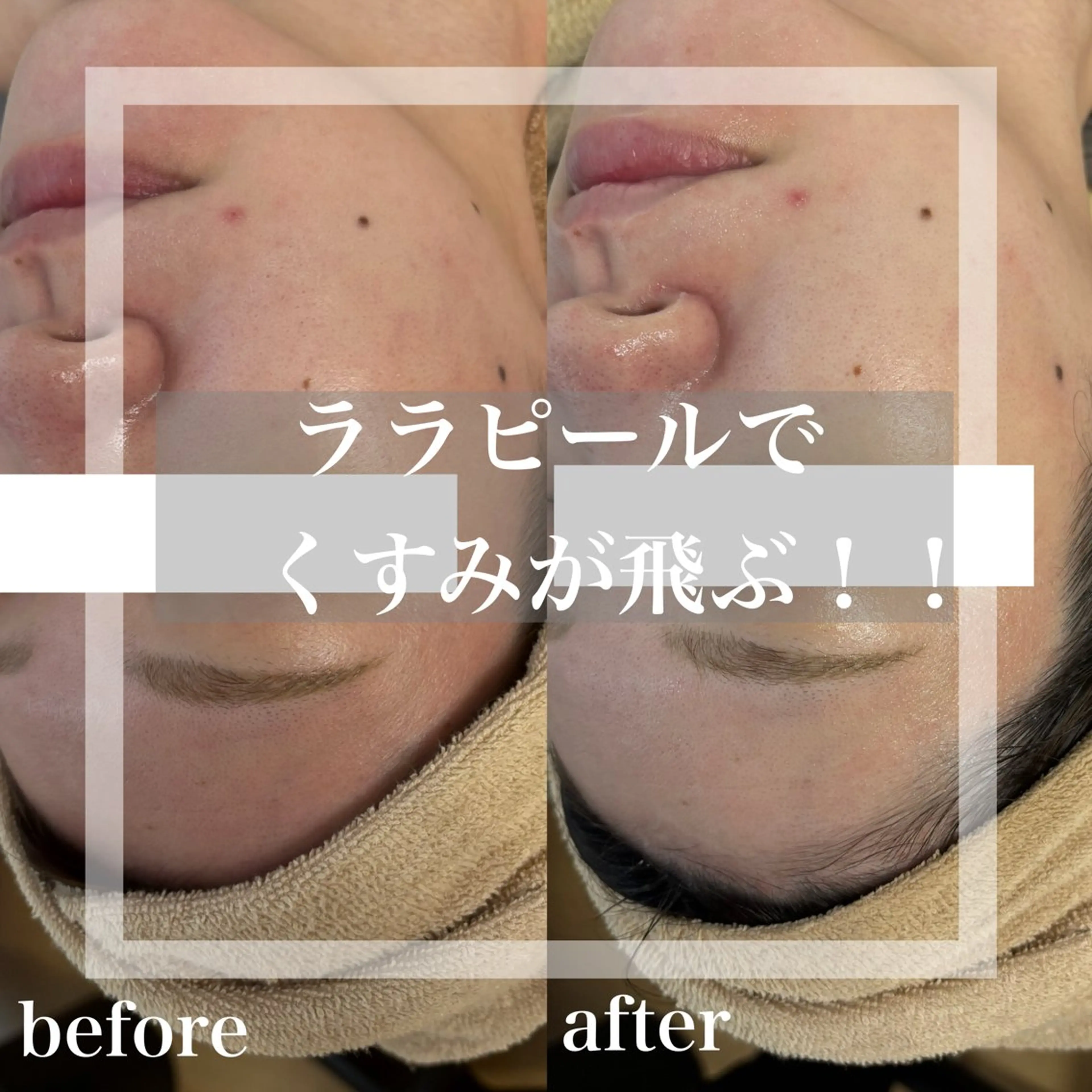 その他 WHITE AQUA 北千住店のエステ・リラクイメージ