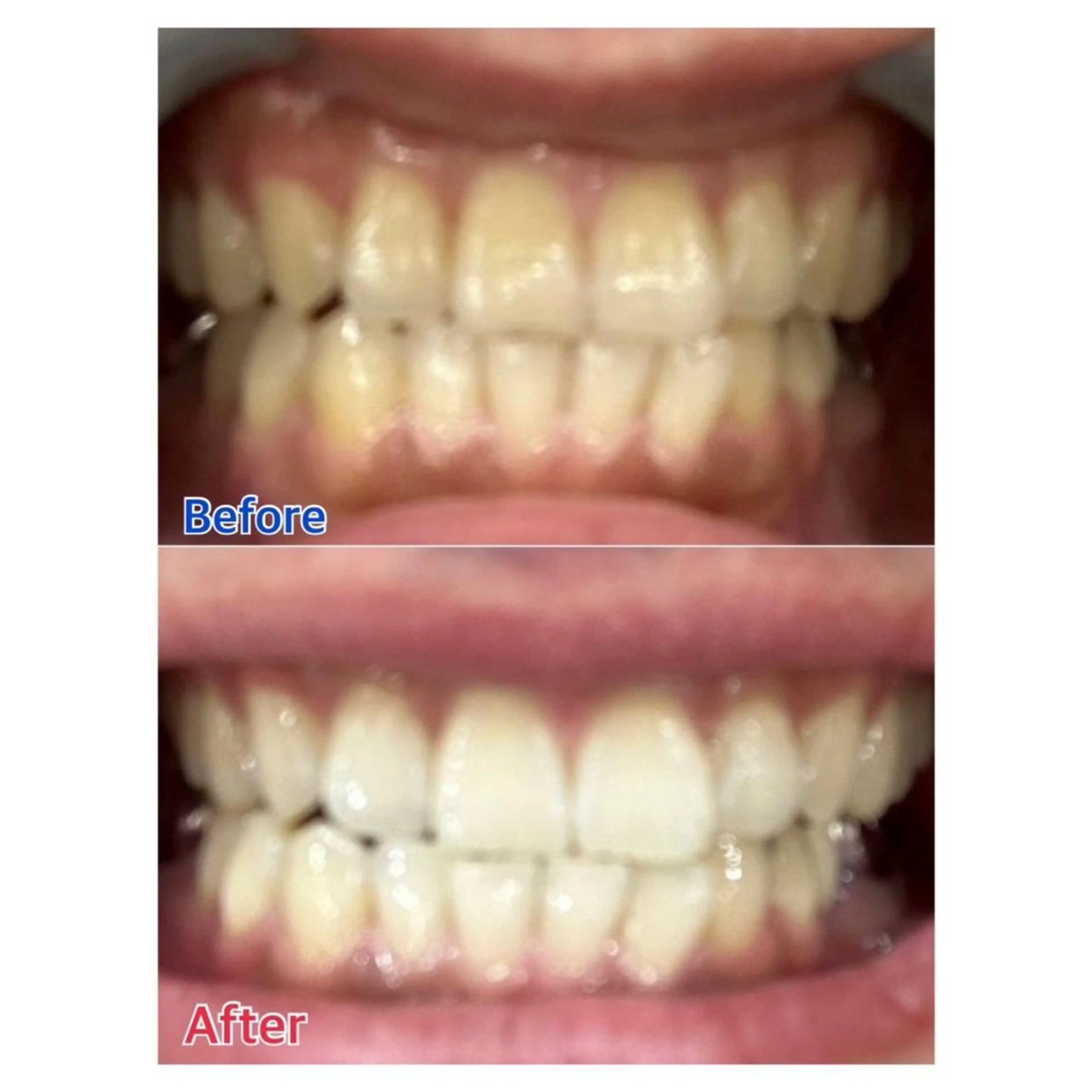 MBEAUTYSALON 千葉店・京成大久保所属・Melty 輝のその他イメージ