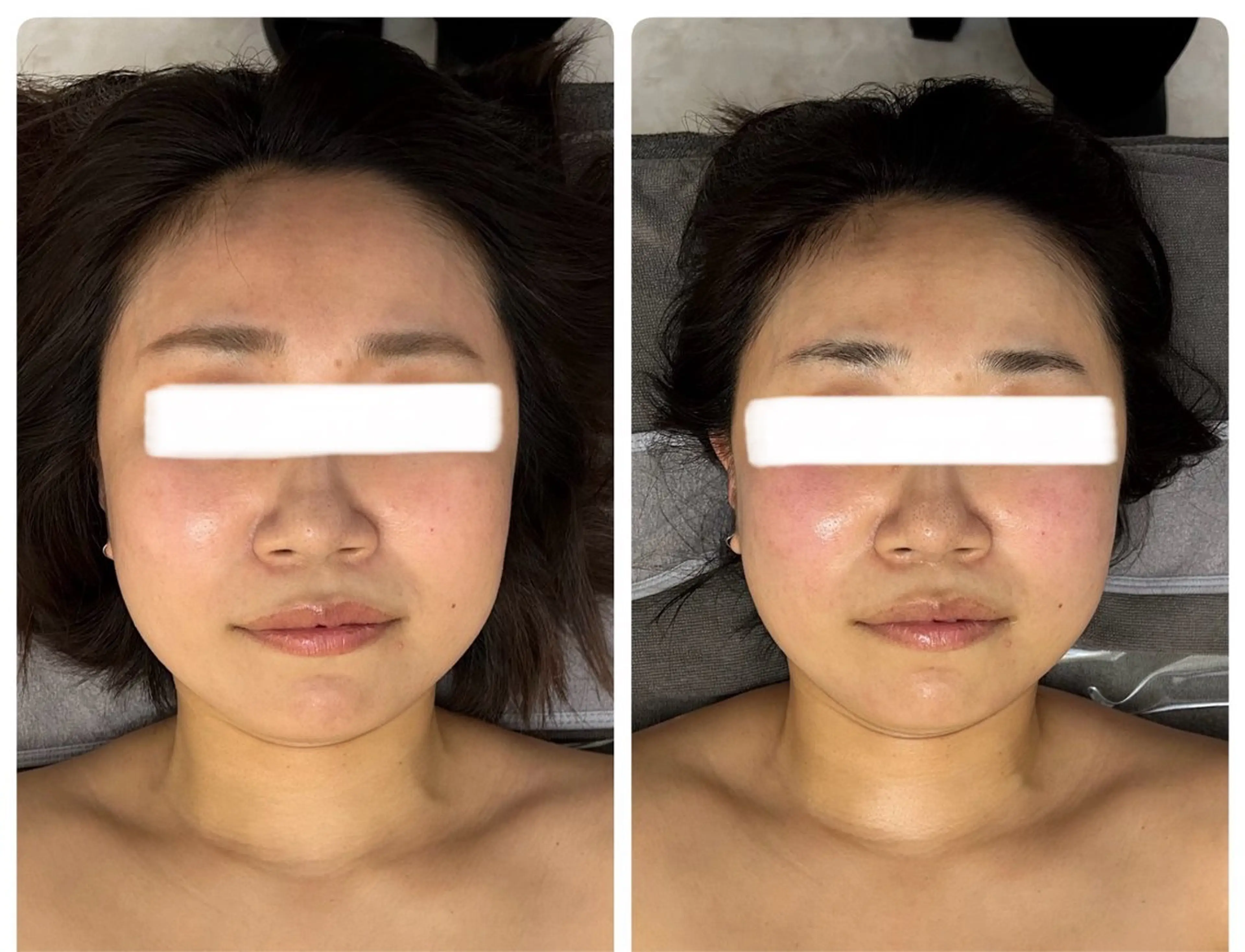 温熱ラジオ派❤️🔥×小顔コルギ💆🏻♀️🫧×小顔定着石膏パック🗿✨の写真