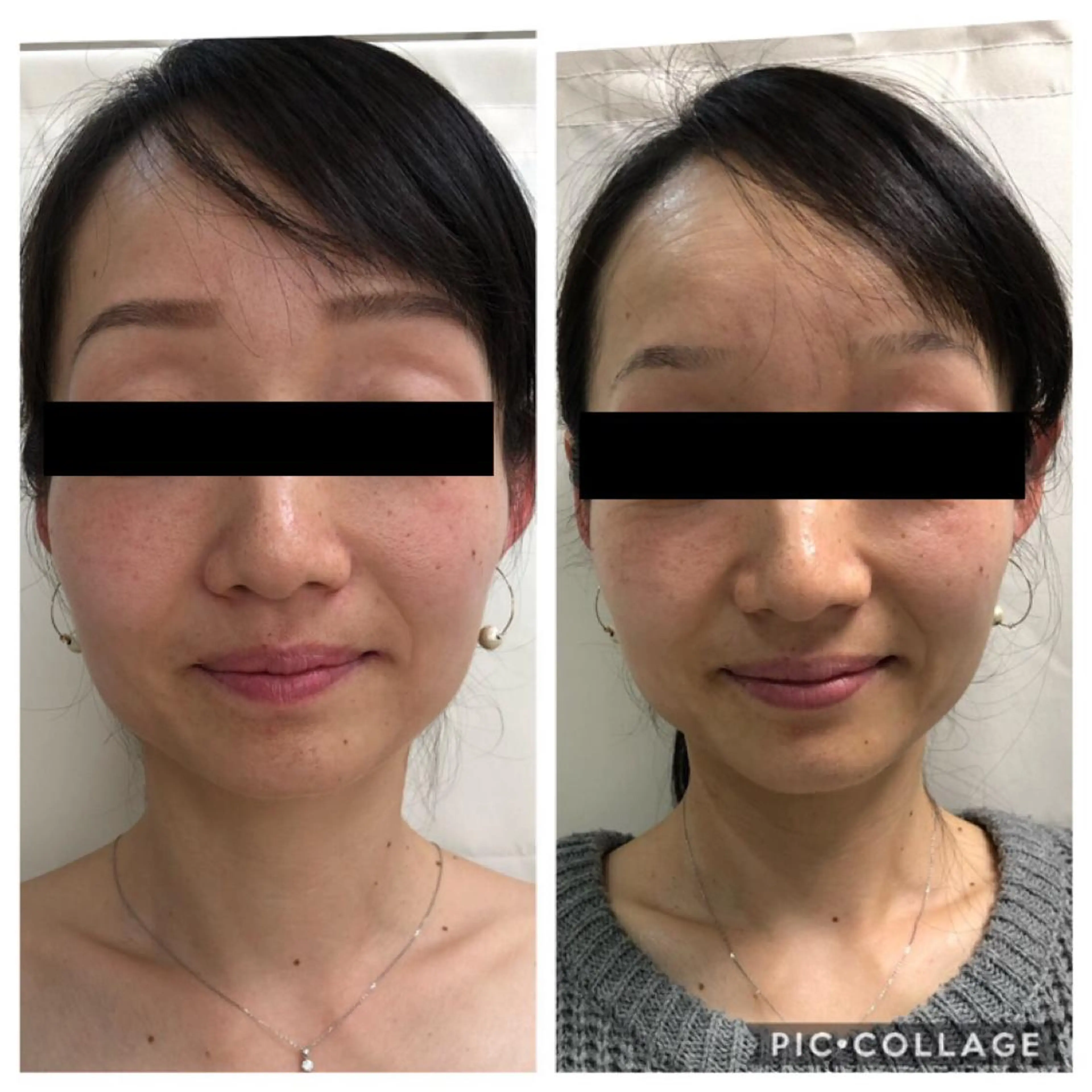 エステ BeautySalonGemmy所属・Gemmy 愛美のエステ・リラクイメージ