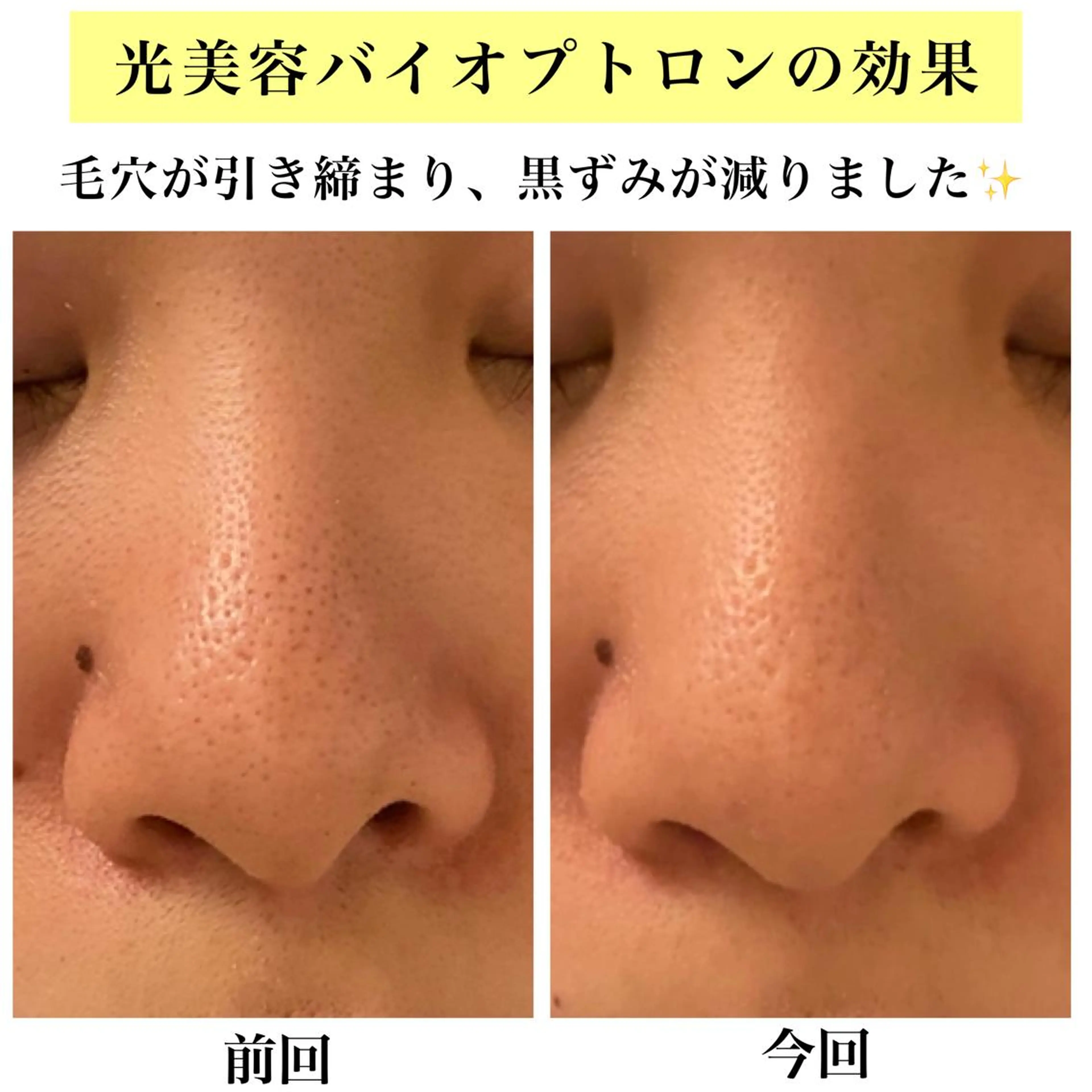 エステ リラク Bellesthe (ベルエステ)のエステ・リラクイメージ