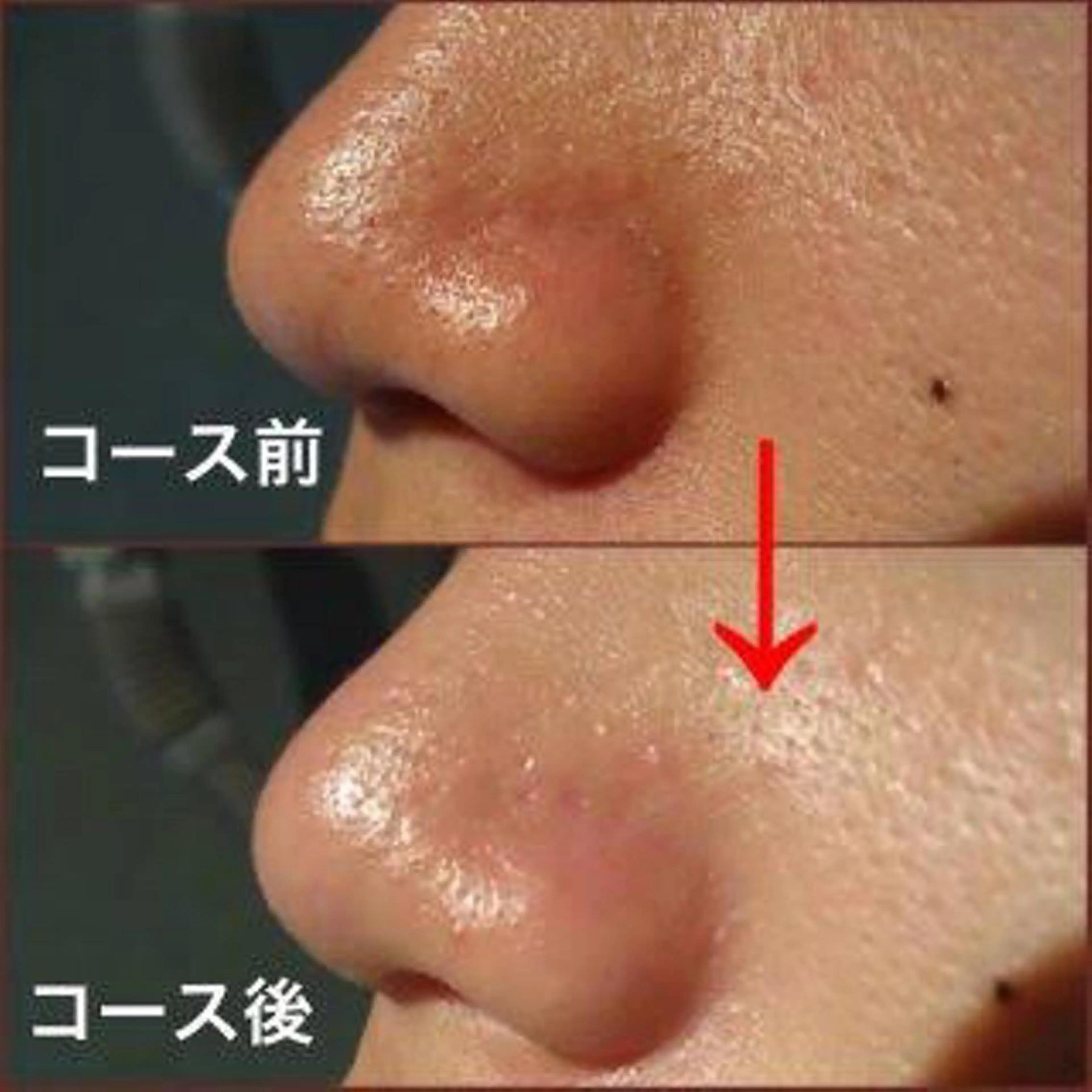 カラー メンズ ネイル 毛穴，ニキビ跡 改善総合サロンのその他イメージ