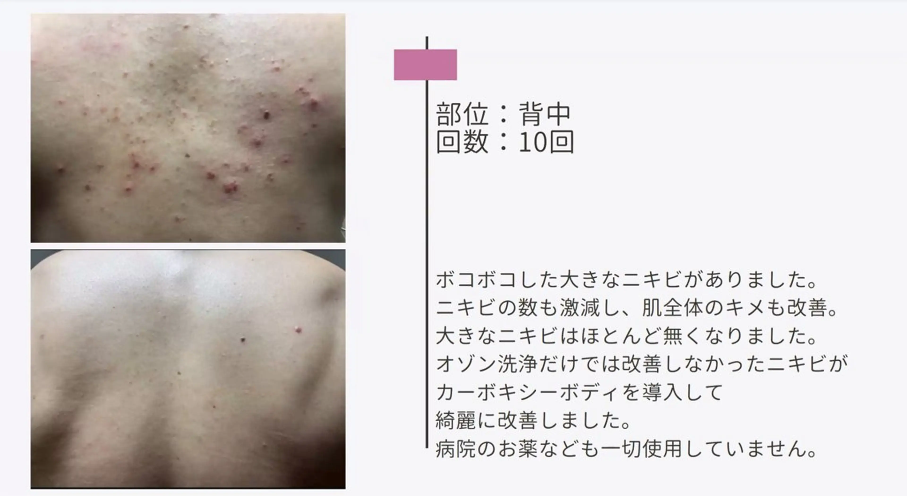 エステ 艶肌ワックス ALLY.のエステ・リラクイメージ