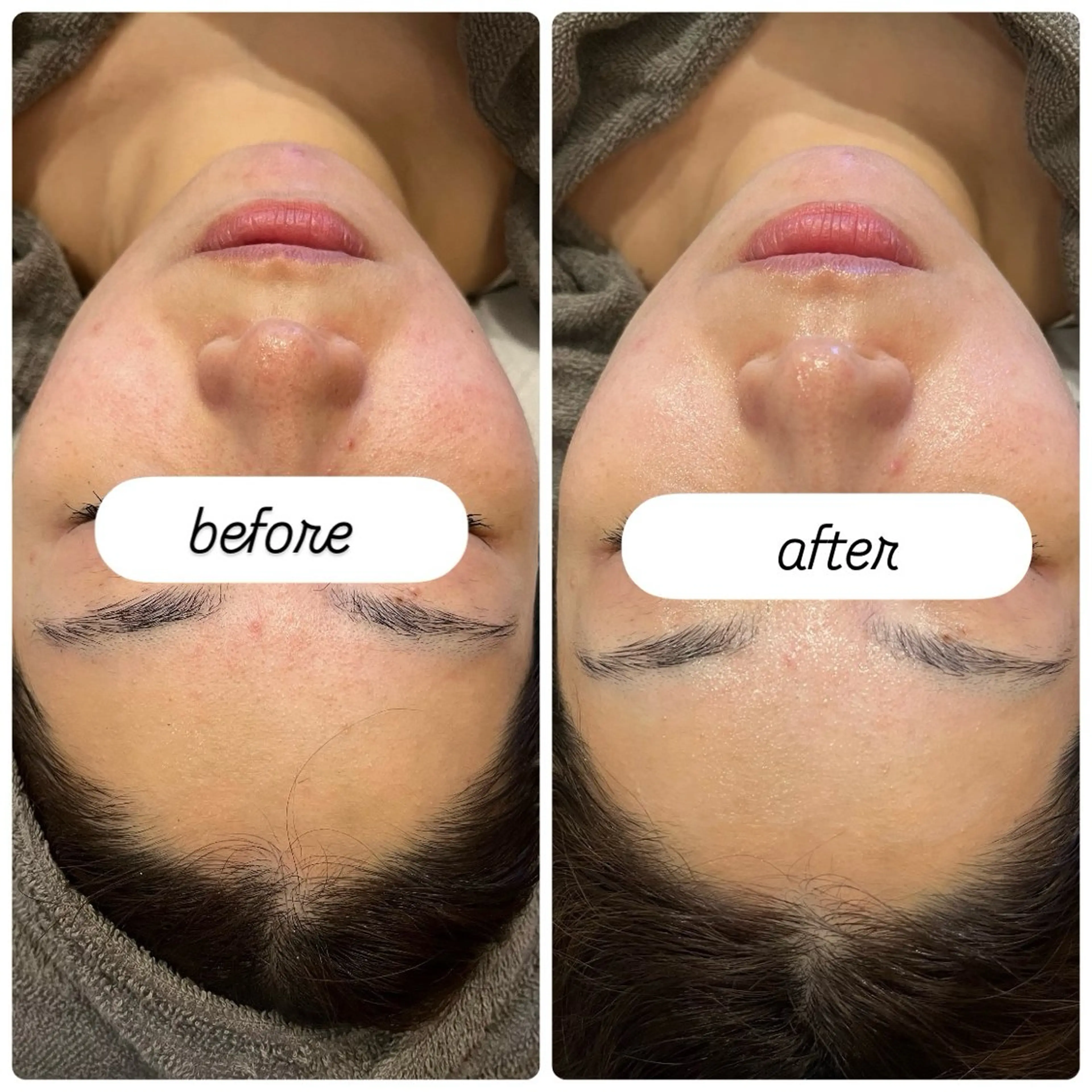 エステ yellow.所属・yellow💛【 脱毛&フェイシャル】のエステ・リラクイメージ