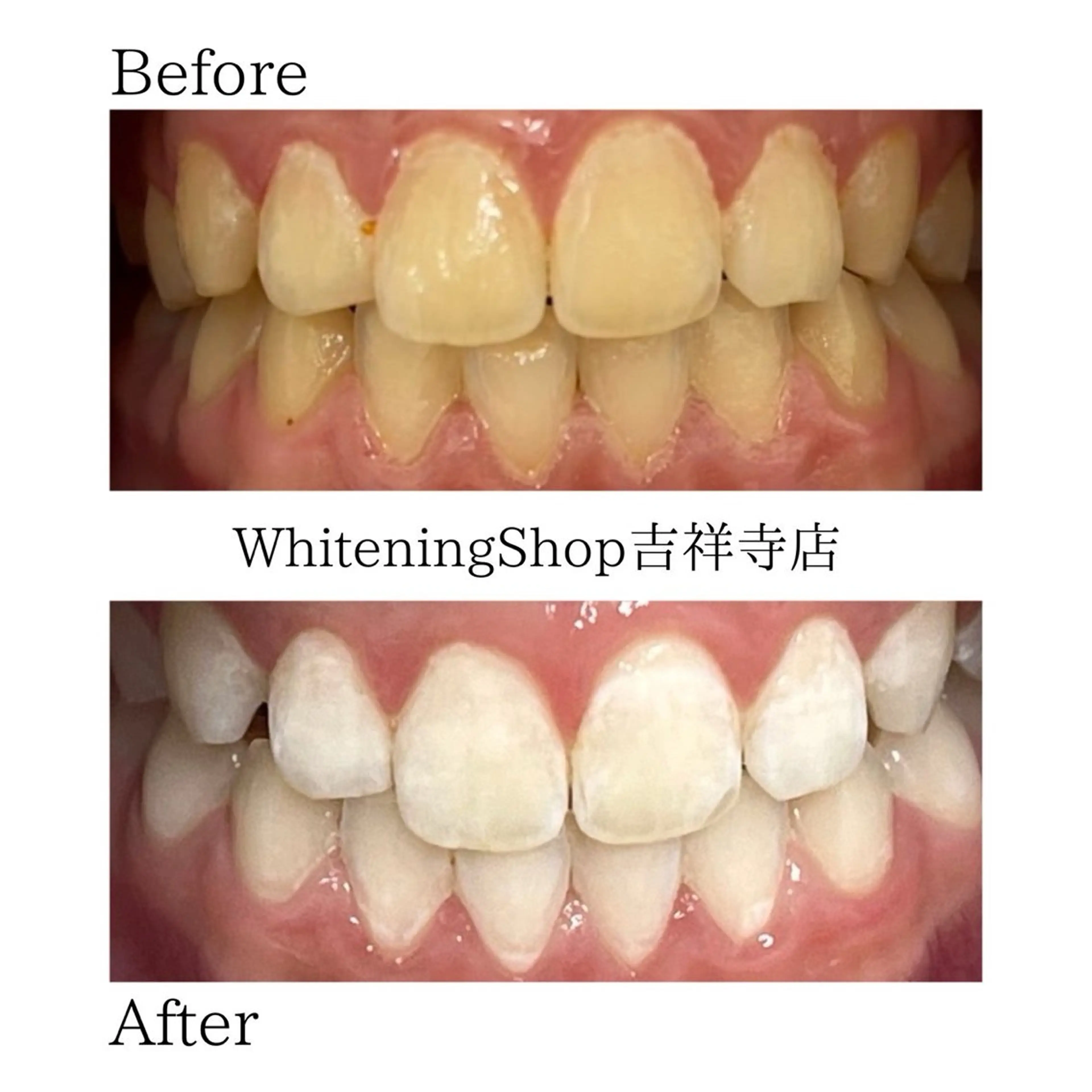 ホワイトニング ショップ吉祥寺店のエステ・リラクイメージ