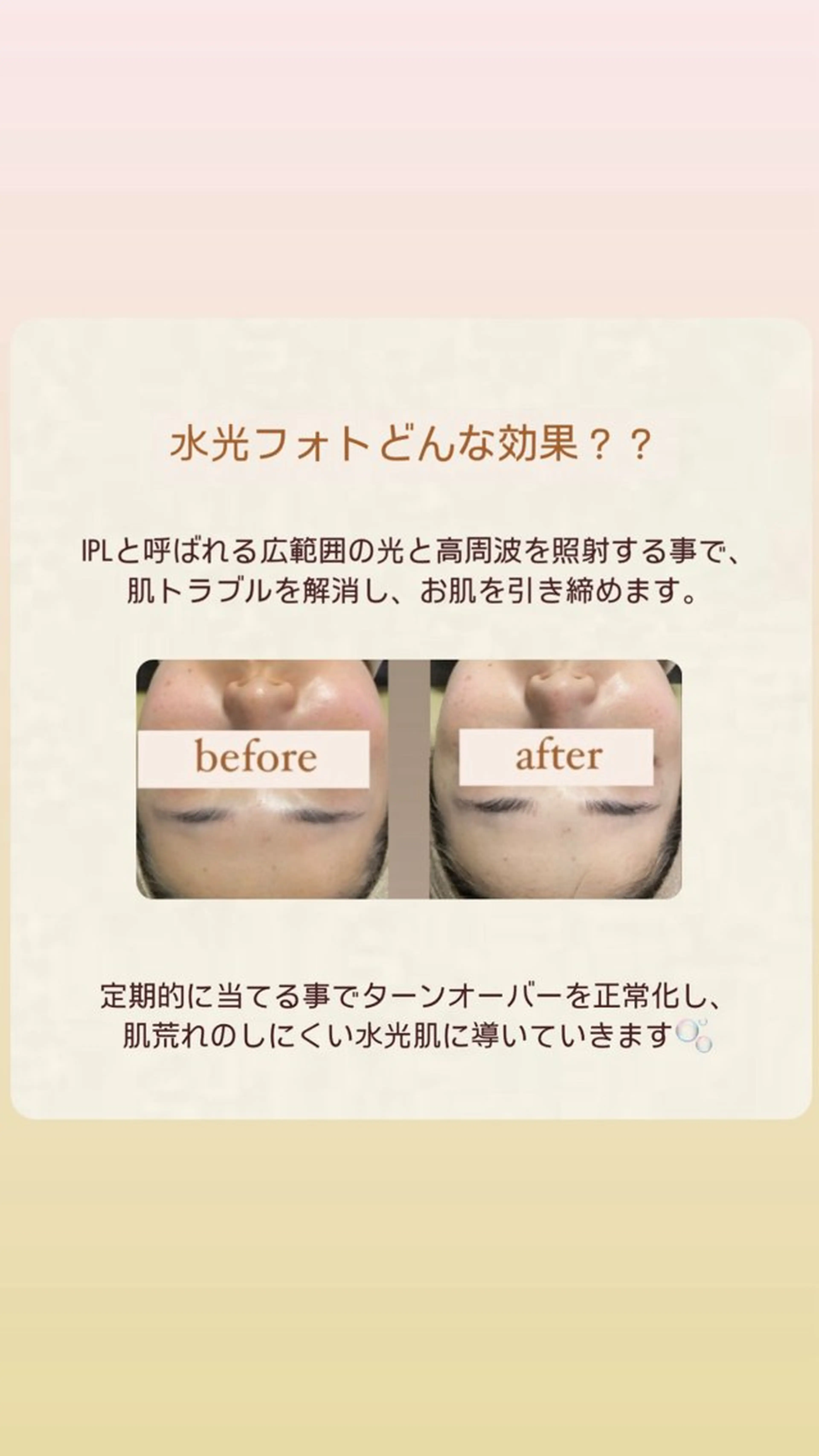 エステ crescent所属・【韓国肌管理・脱毛】 クレセントのエステ・リラクイメージ