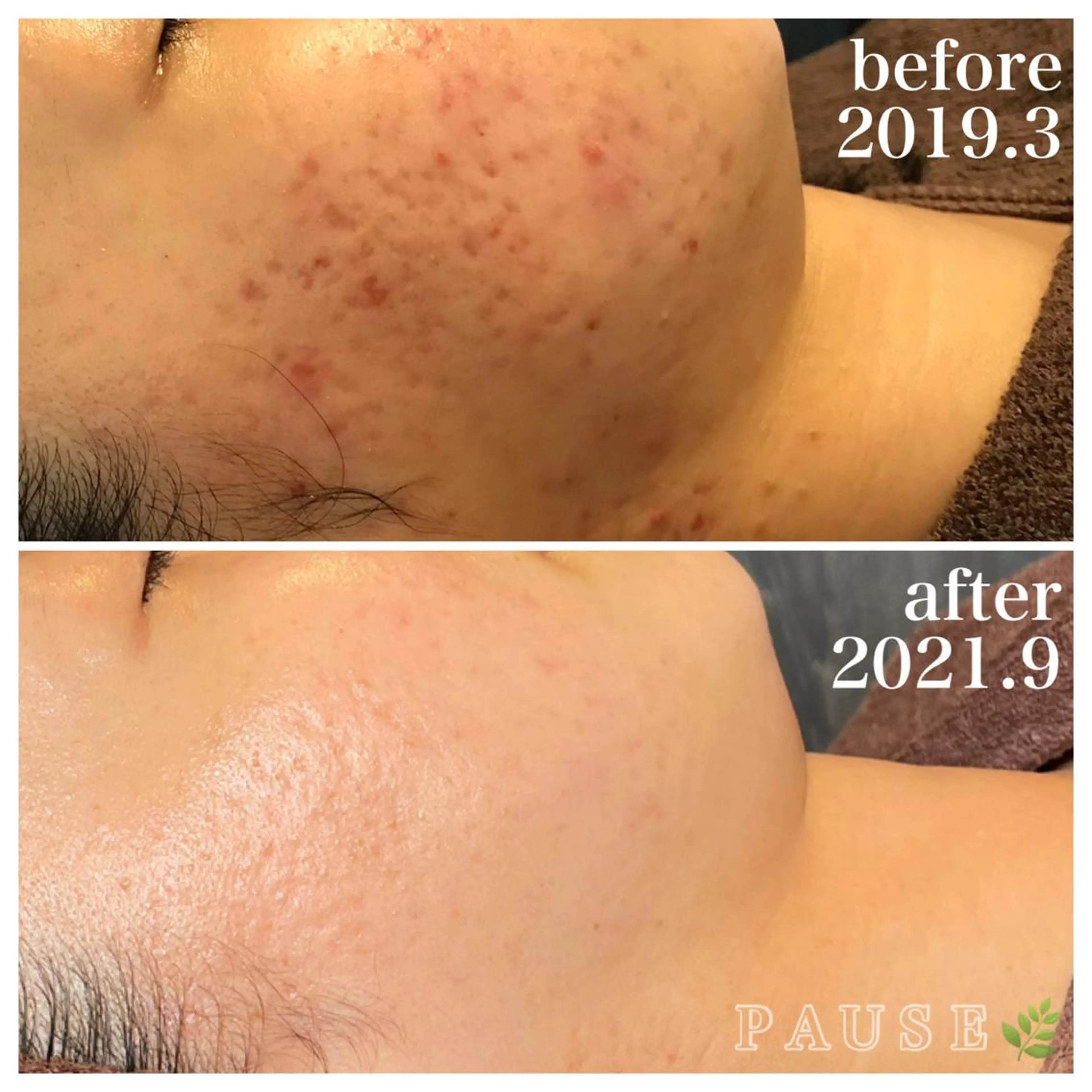 エステ 浜野 恵美のエステ・リラクイメージ