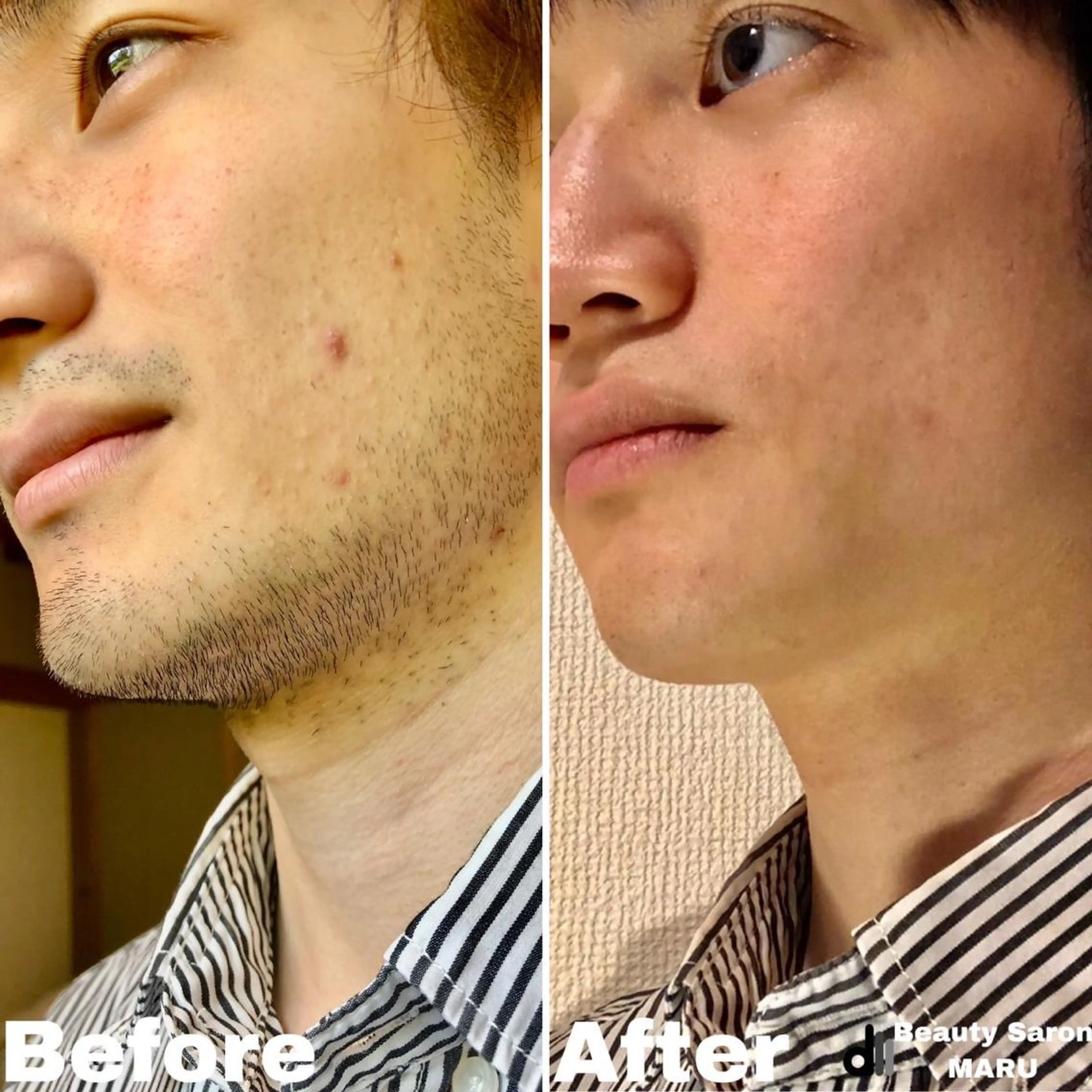 メンズ Beauty Salon MARU所属・新潟市メンズ【脱毛】 MARUのエステ・リラクイメージ