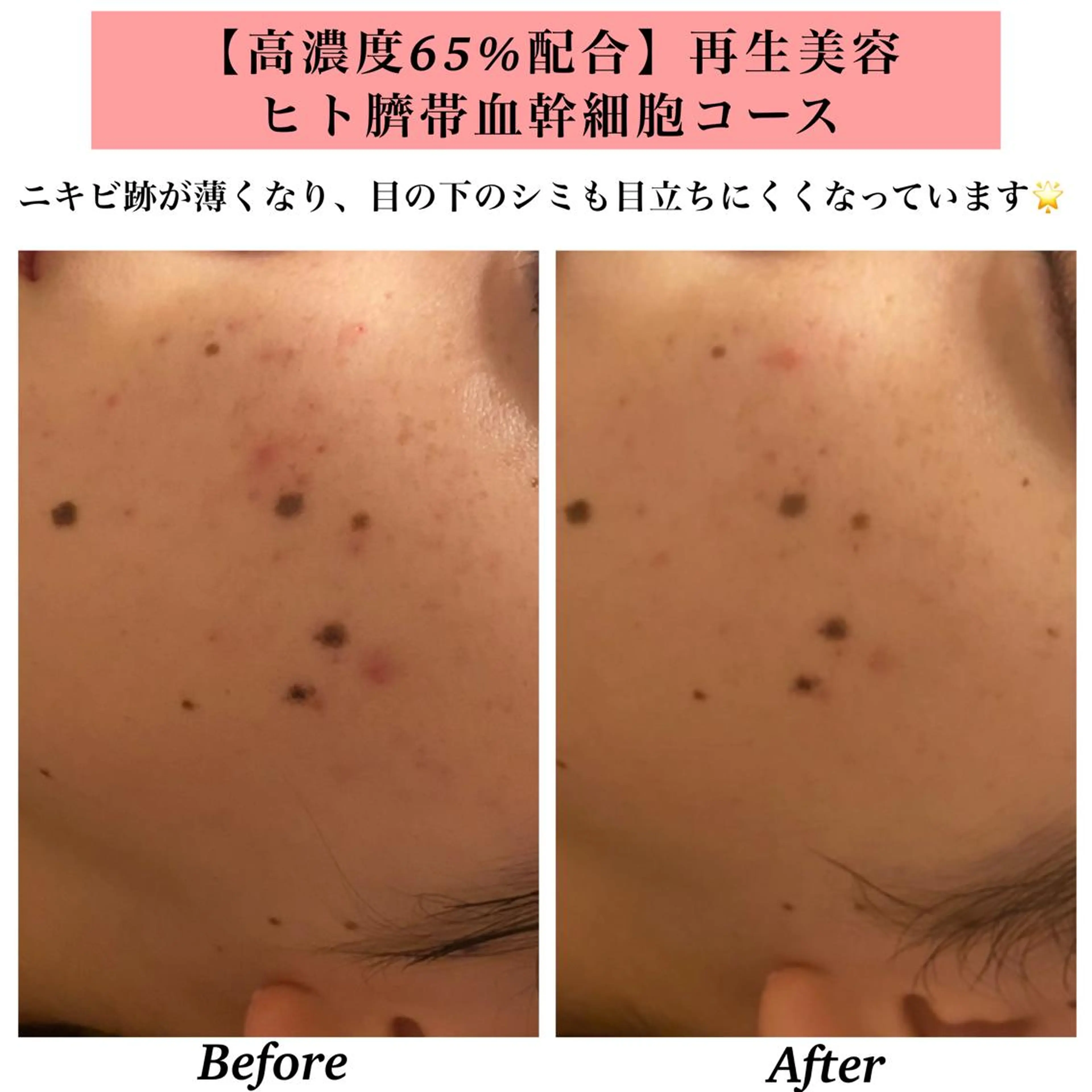 エステ リラク Bellesthe （ベルエステ）のエステ・リラクイメージ