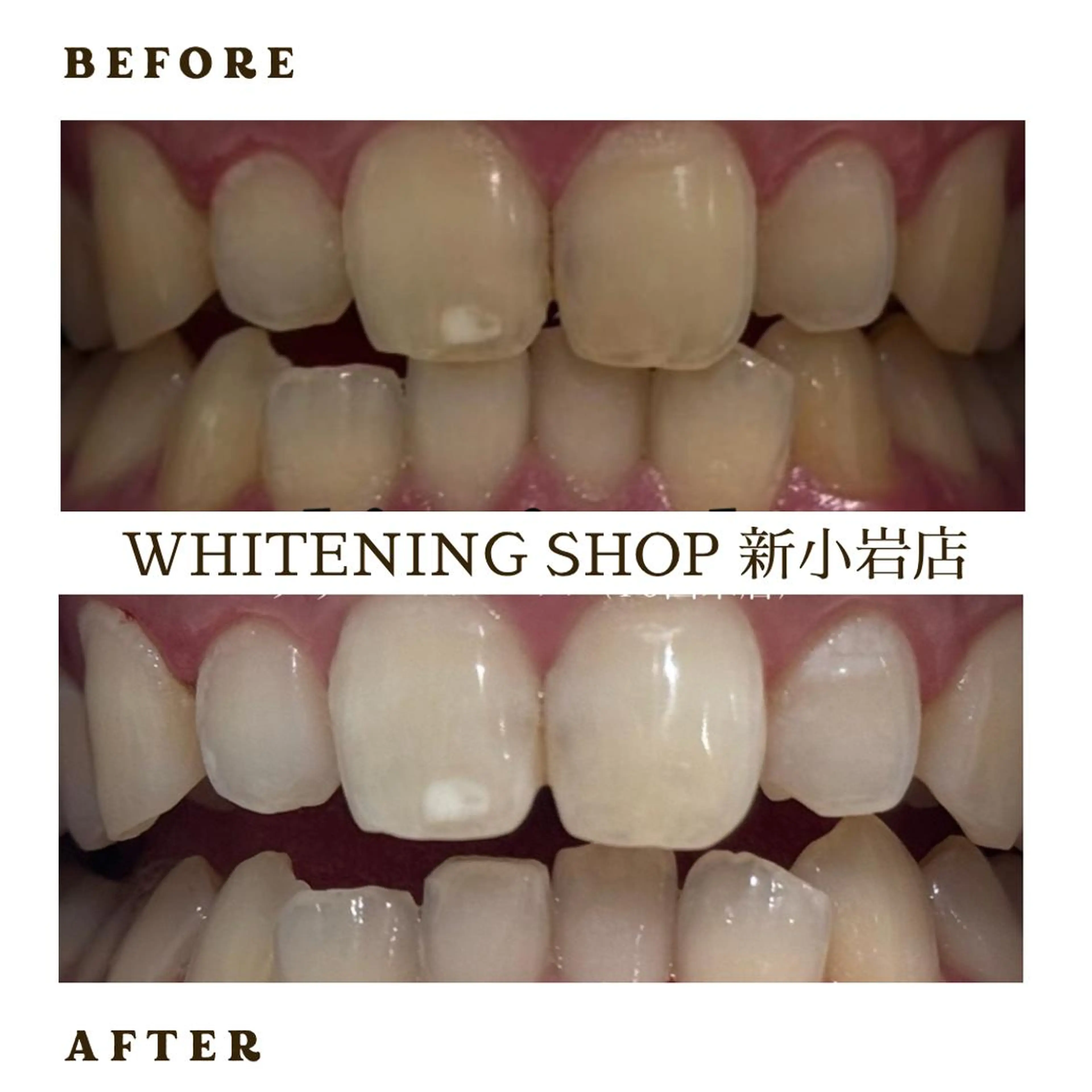 メンズ ホワイトニング ショップ新小岩店のその他イメージ