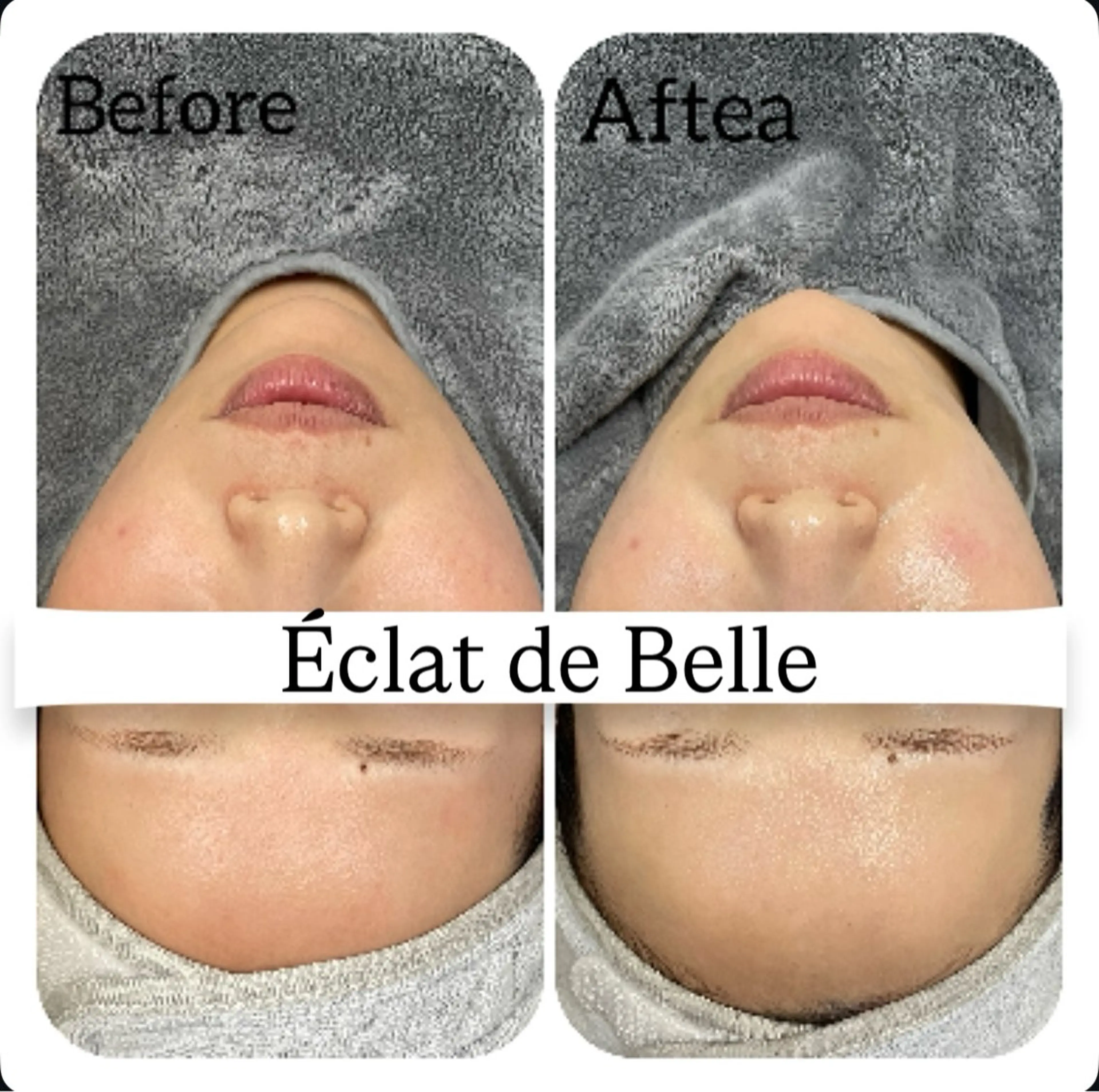 エステ Éclat de Belle🫧白玉肌のエステ・リラクイメージ