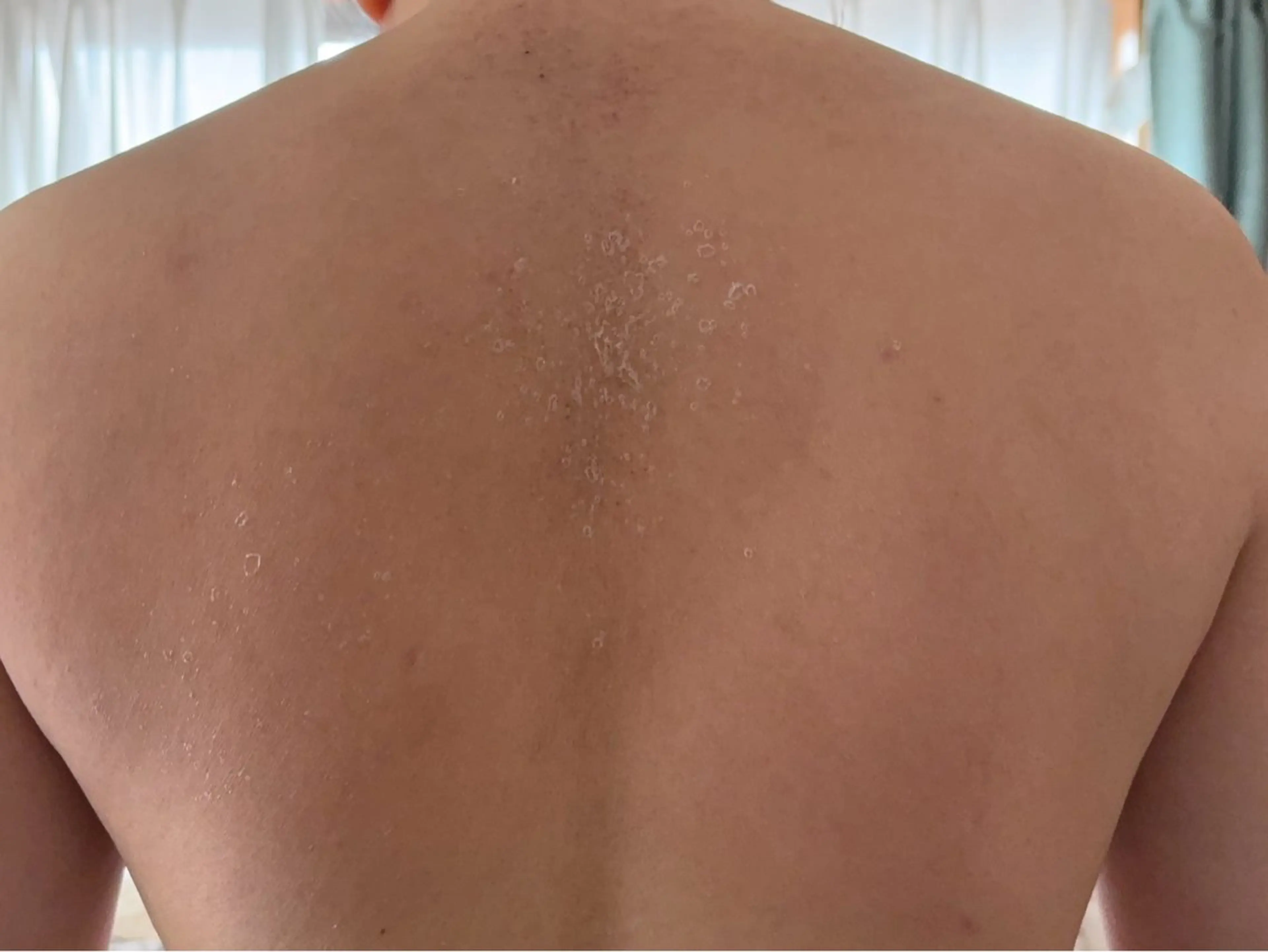 エステ clé skin 🌿ハーブピーリングのエステ・リラクイメージ