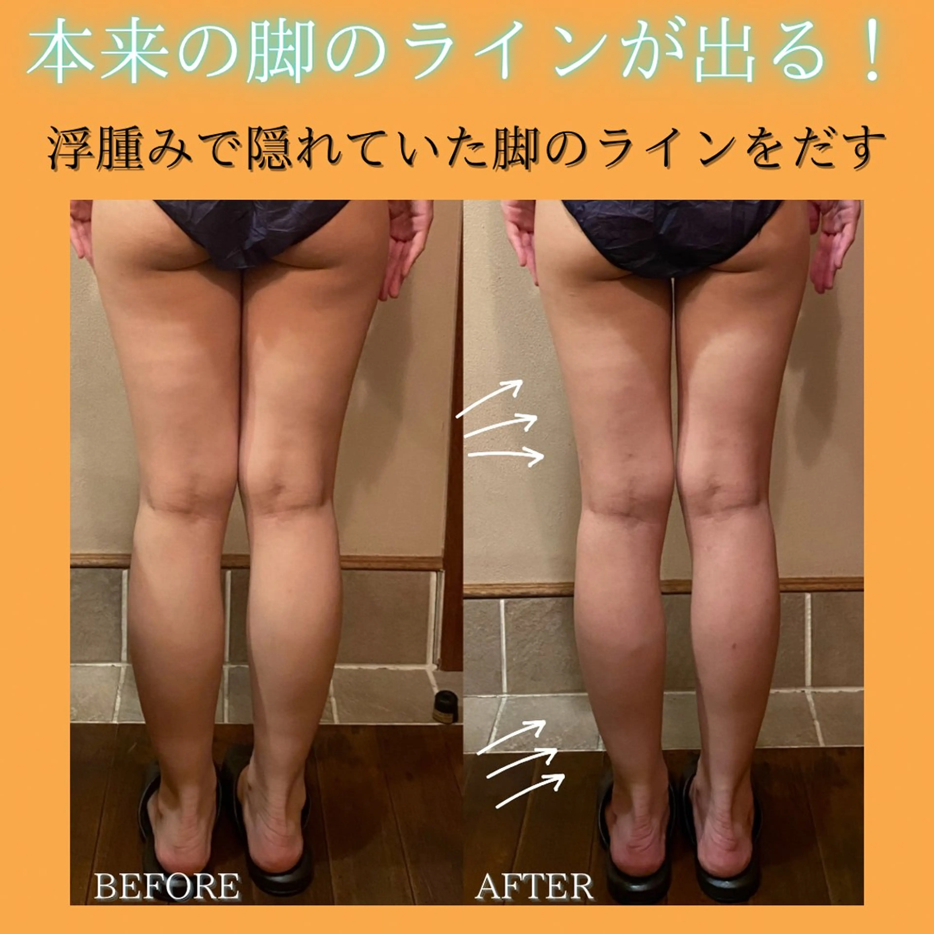 【ぽよ尻・重だるい脚徹底ケア🔥】筋肉と脂肪の塊をほぐして綺麗なライン作り💗浮腫み・セルライト・冷え対策🎀の写真