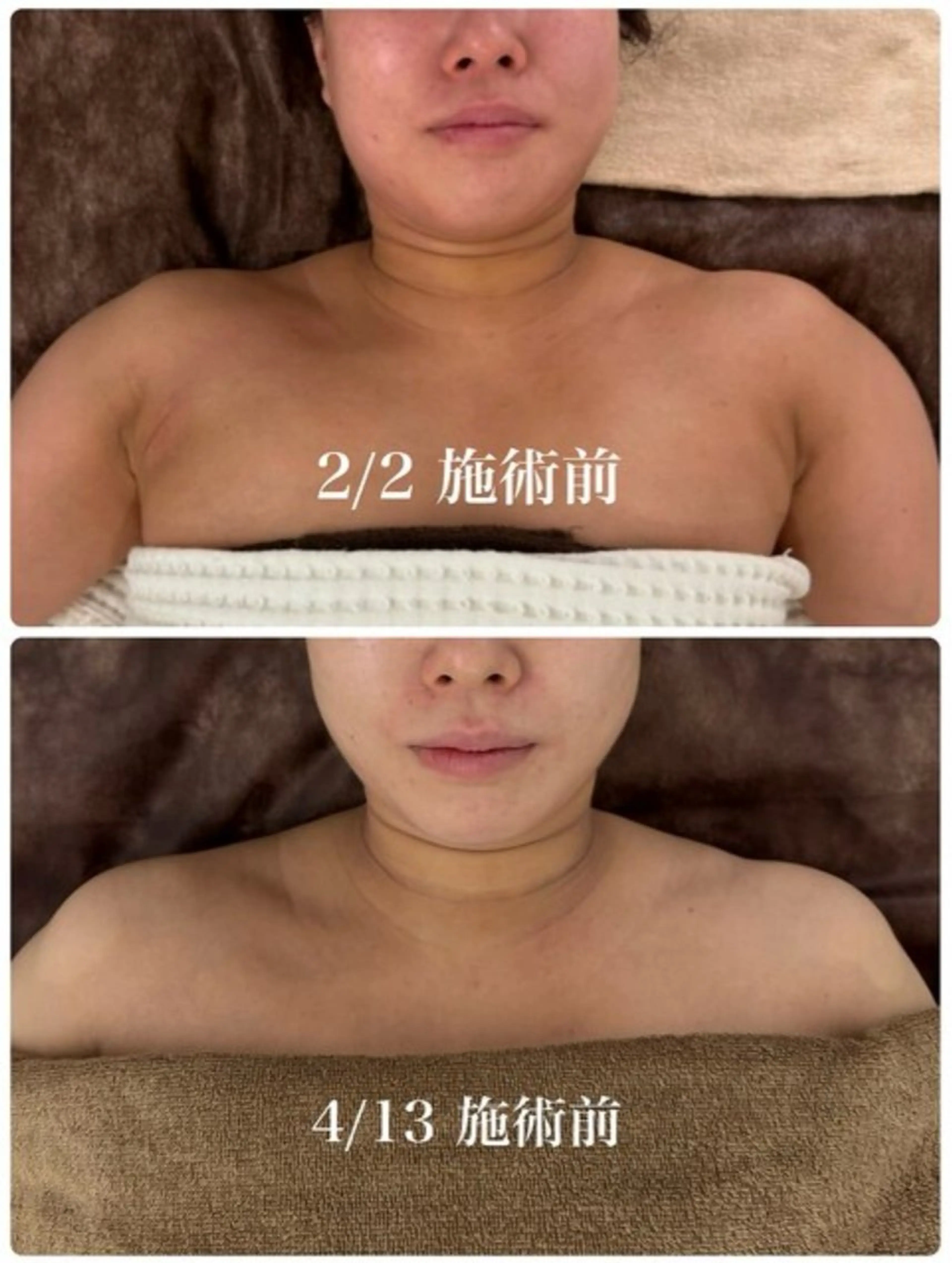 メンズ エステ リラク 小顔フェイシャル 専門店Soarのエステ・リラクイメージ