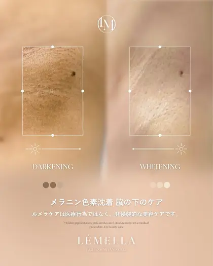 マツエク・まつげパーマデザインカタログ「メラニンケアLÉMELLA