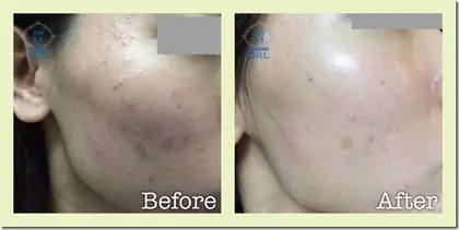 dc046a8f8874169d1a2cdac57a3852