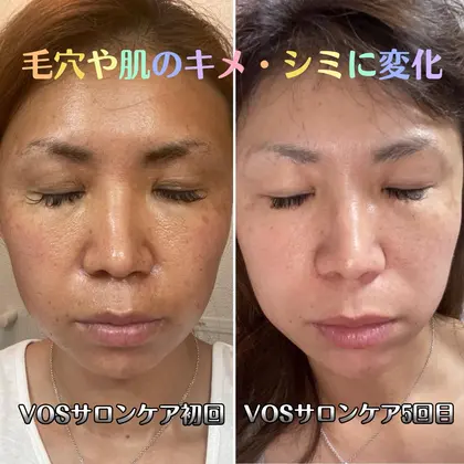【残り２セット】VOS サロンケア　２回セット☆コメント必須 残り2セット】VOS サロンケア 3回セットコメント必須