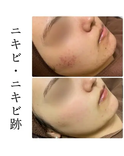 33654c28b7608195b7ef56c8d978cf