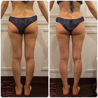 ハイパーシェイプとハイパーナイフ 410606fe83beab041cf7ad1969a9c7