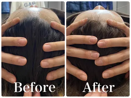 ◾️最終価格◾️はじめての人のための頭蓋骨矯正 cf68f02076e92b23a237439b19c44a