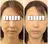 水光肌ピーリング ハーブピーリングのプロフィール画像