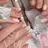 SI NAIL