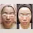 AnyaBeauty アーニャビューティー
