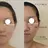 整形級の変化👀 最新✨韓国小顔管理のプロフィール画像